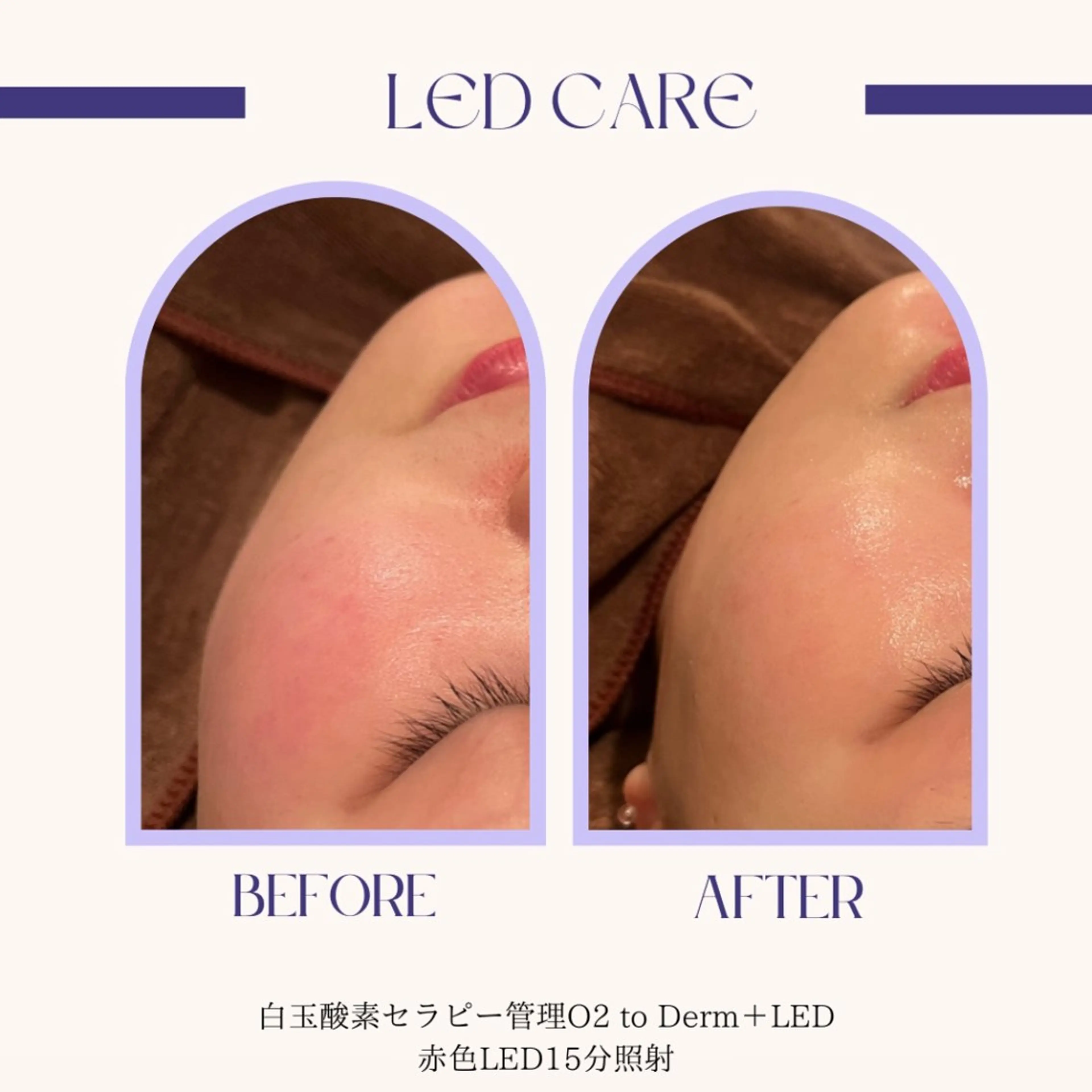 エステ crescent所属・【韓国肌管理・脱毛】 クレセントのエステ・リラクイメージ