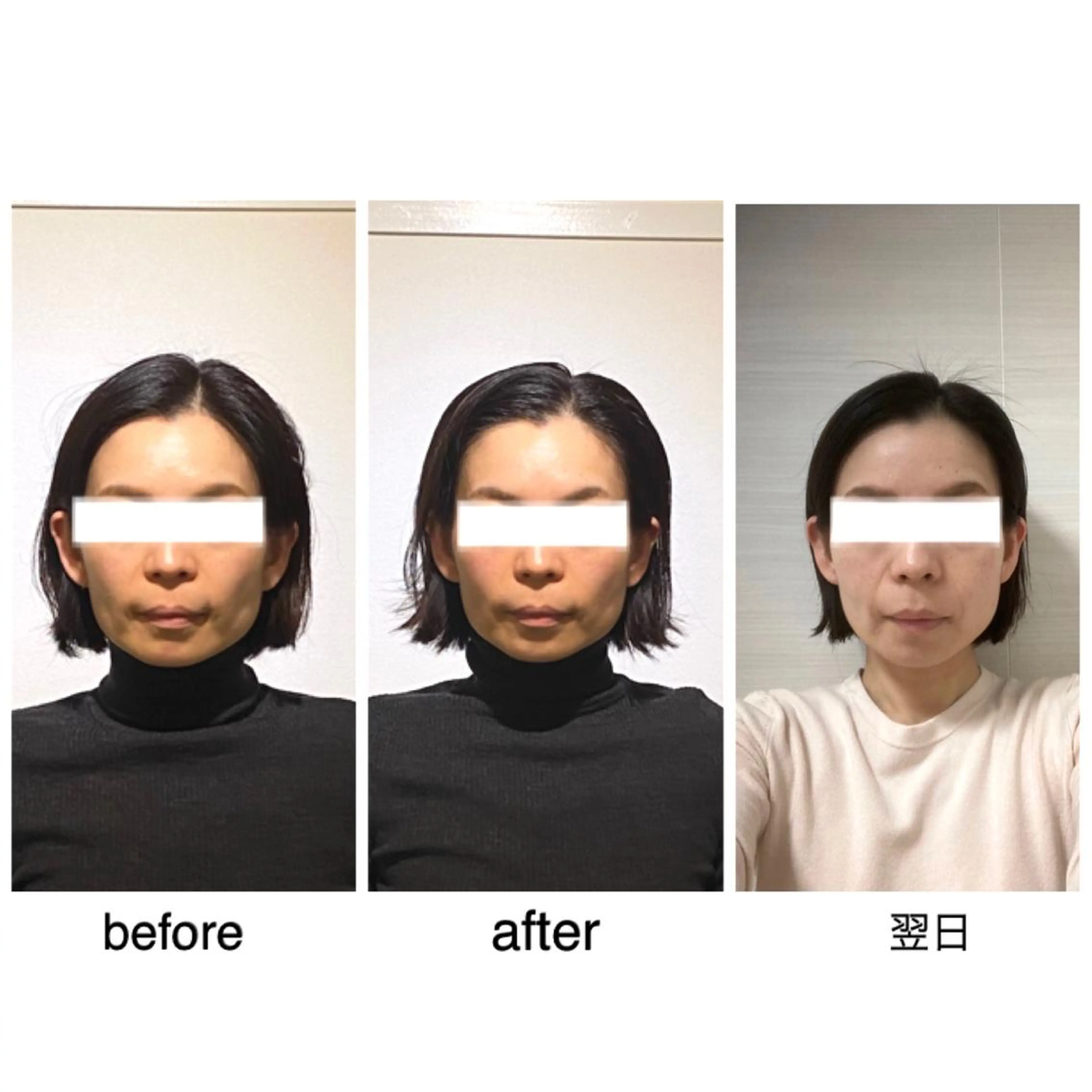 ミディアム カラー ヘアアレンジ ネイル マツエク・マツパ 小顔矯正専門サロンジュマリ所属・町田 淳子のエステ・リラクイメージ