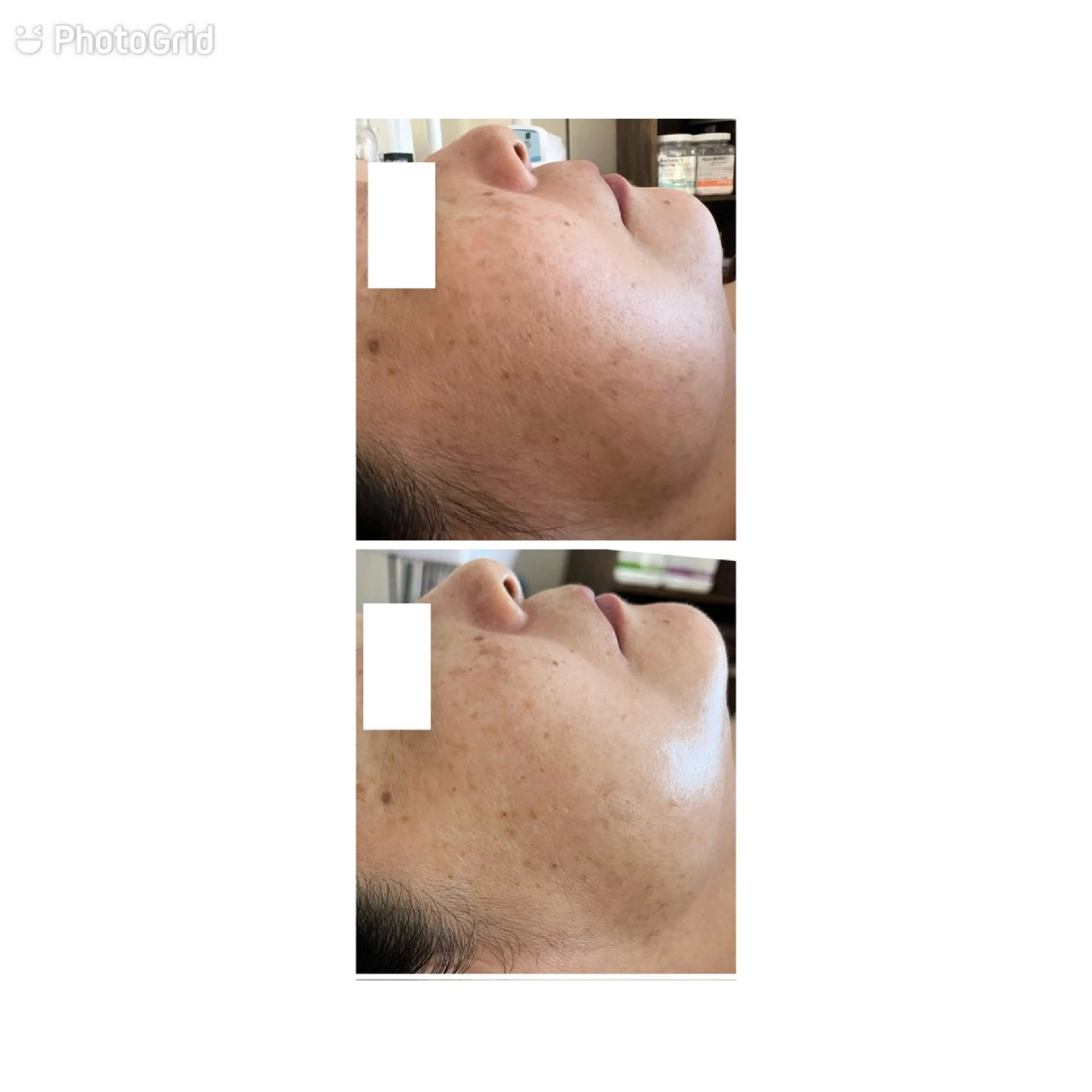 エイジングケア専門 Ponolaのエステ・リラクイメージ