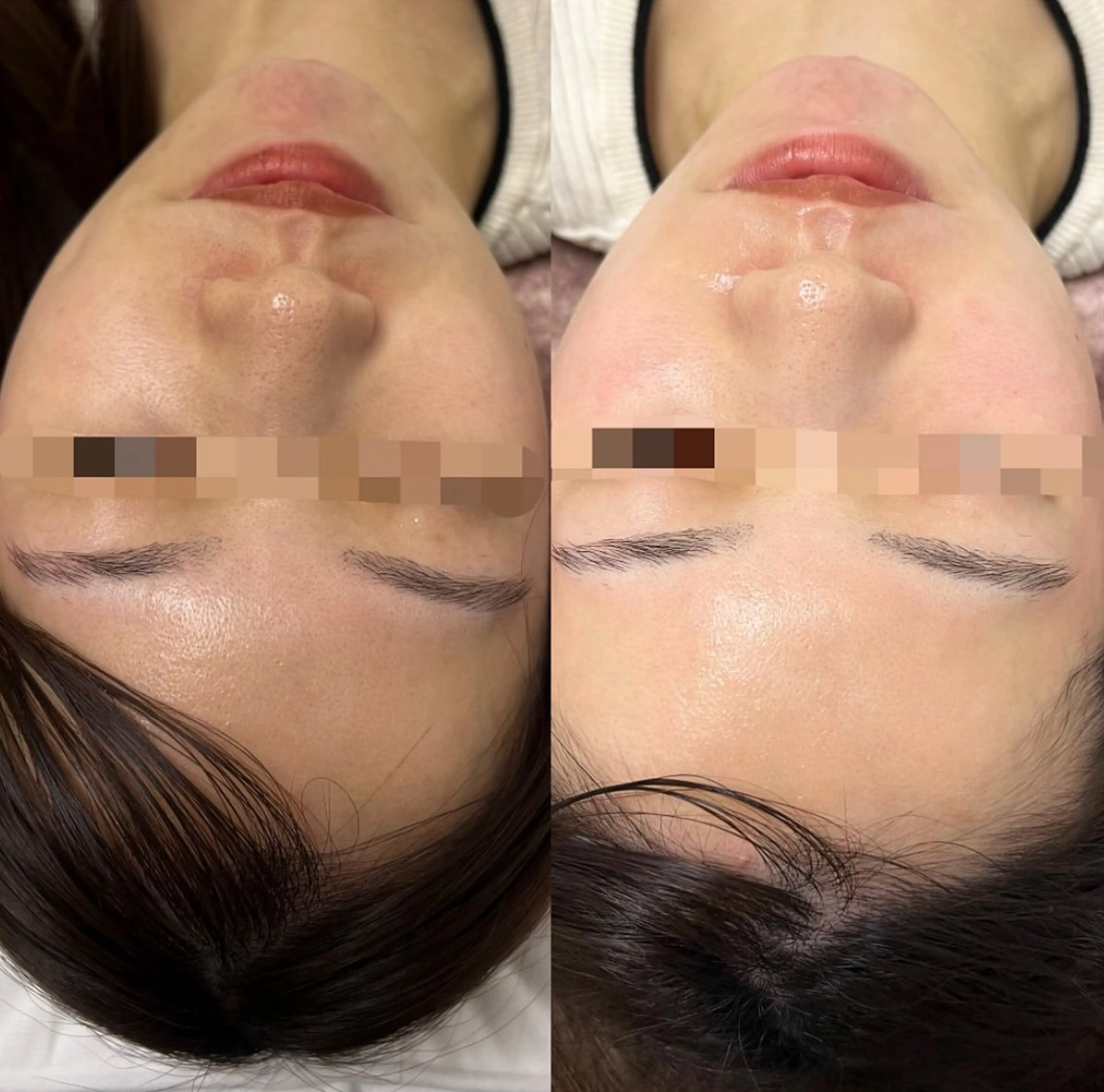 エステ 看護師が施術する美容 ナスサロ/川口のエステ・リラクイメージ