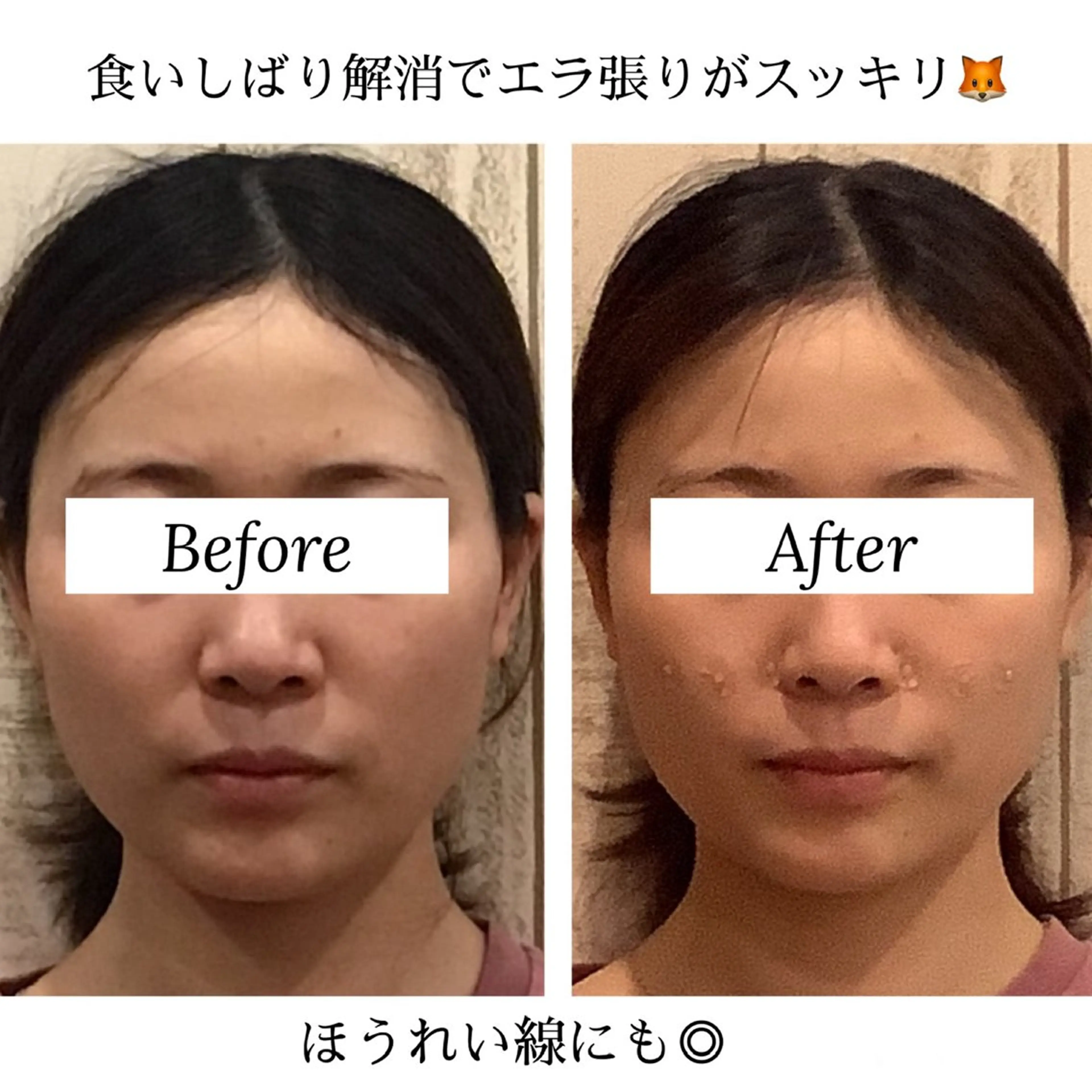 小顔専門☠️ 筋膜/脂肪/毛穴洗浄のエステ・リラクイメージ