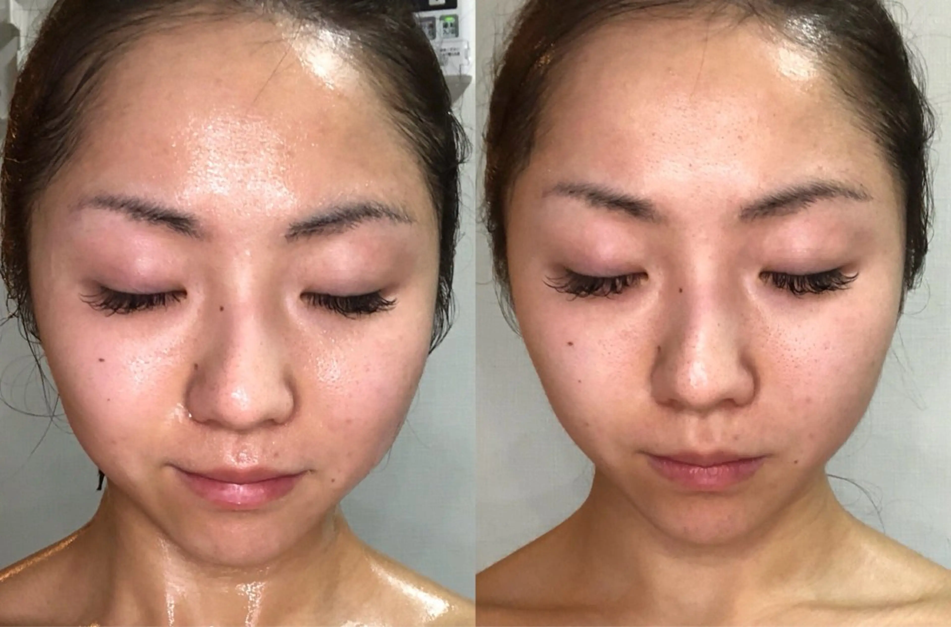 フェイスラインくっきり!小顔フェイシャル💆♀️の写真