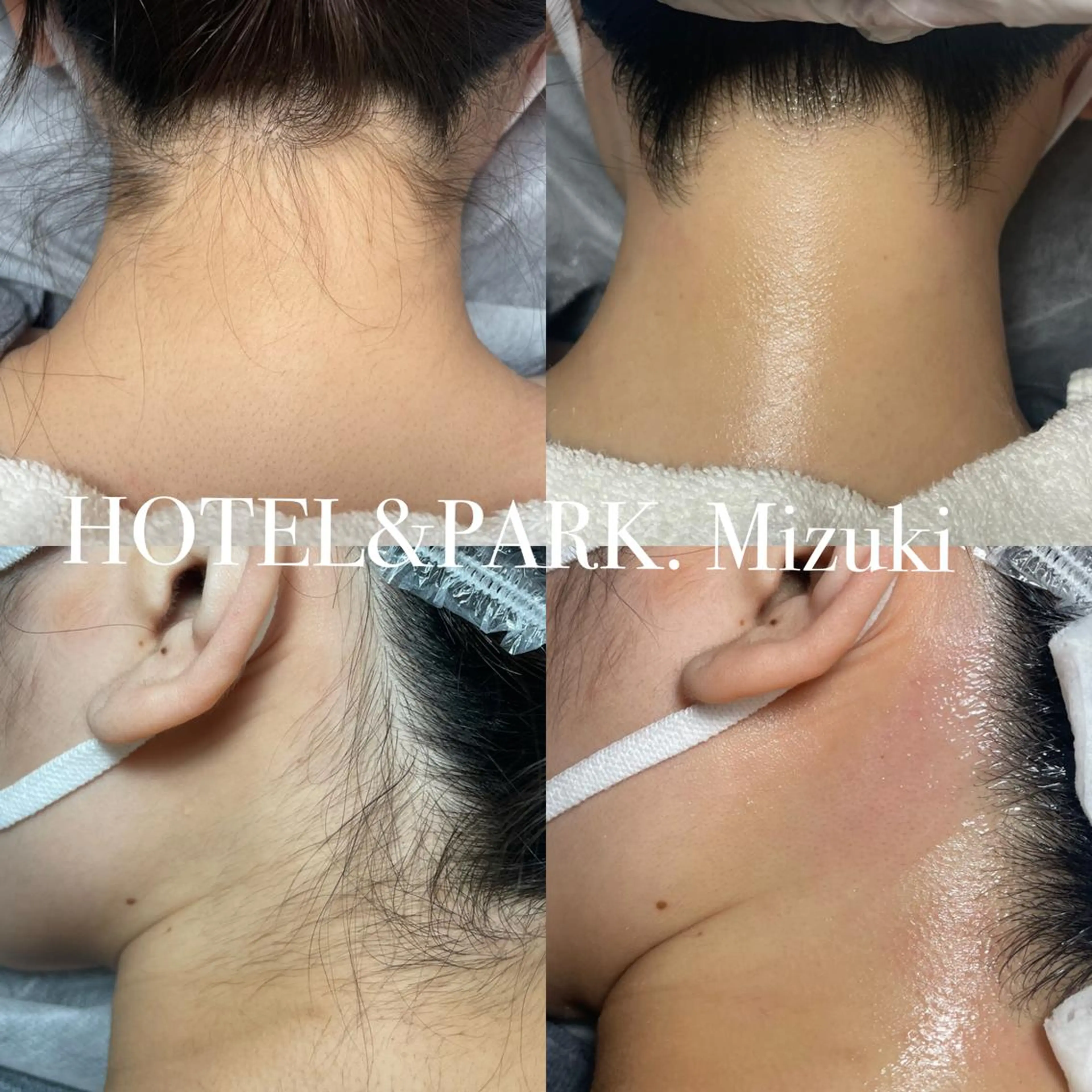 HOTEL&PARK . ワックス脱毛のエステ・リラクイメージ