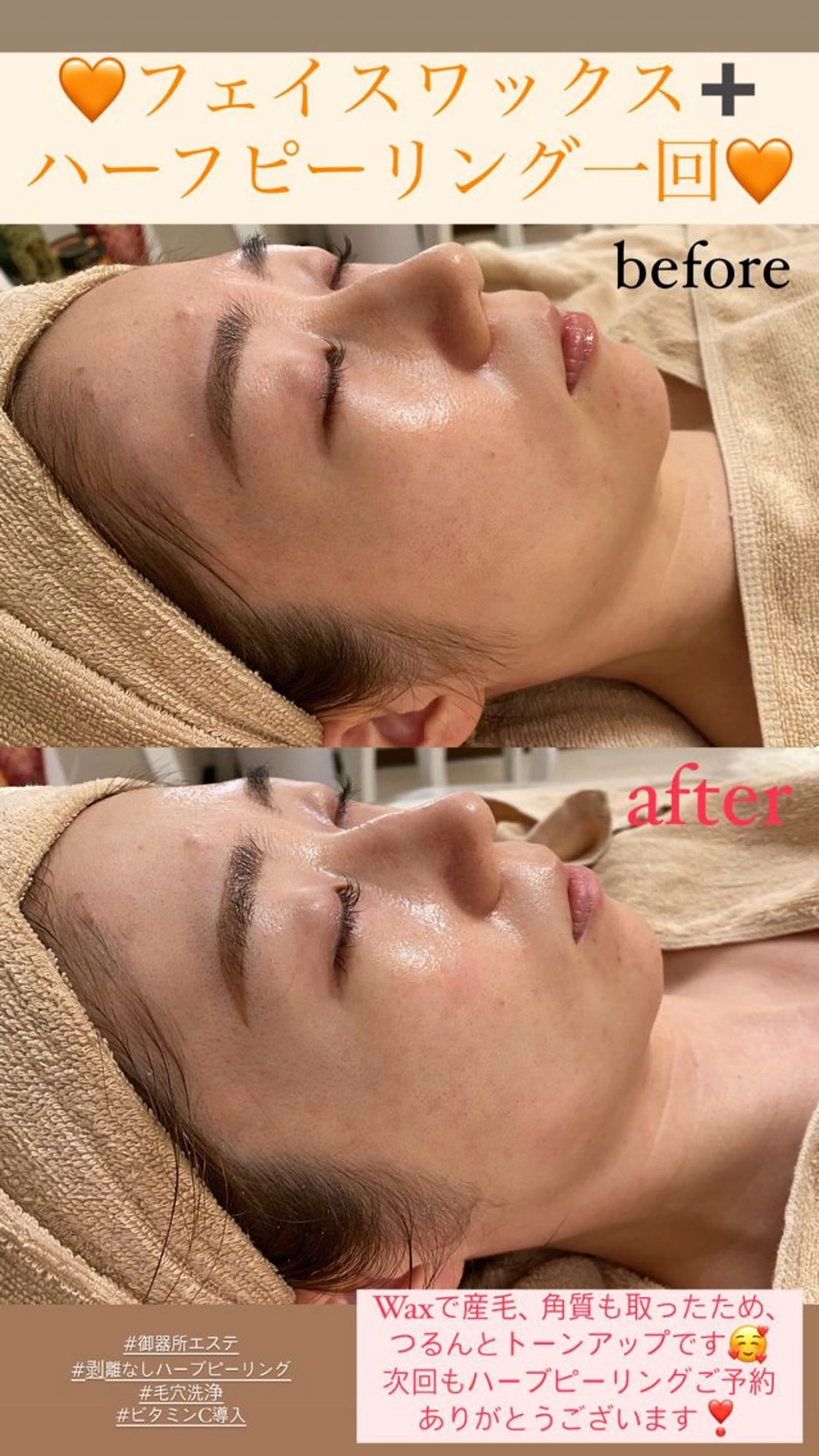 メンズ エステ Salon de Lino 御器所のエステ・リラクイメージ