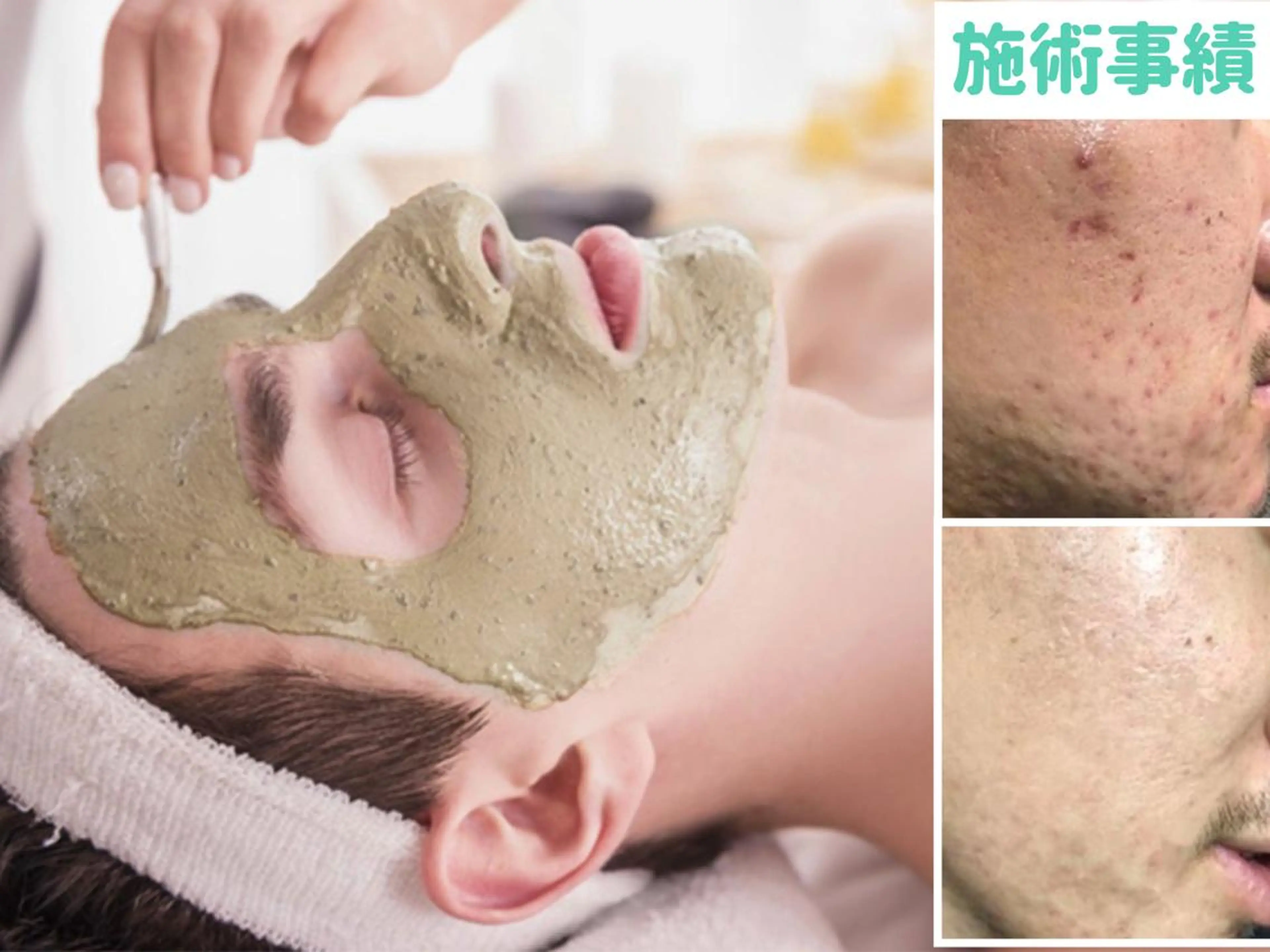 小顔痩身インディバ Nana表参道のエステ・リラクイメージ