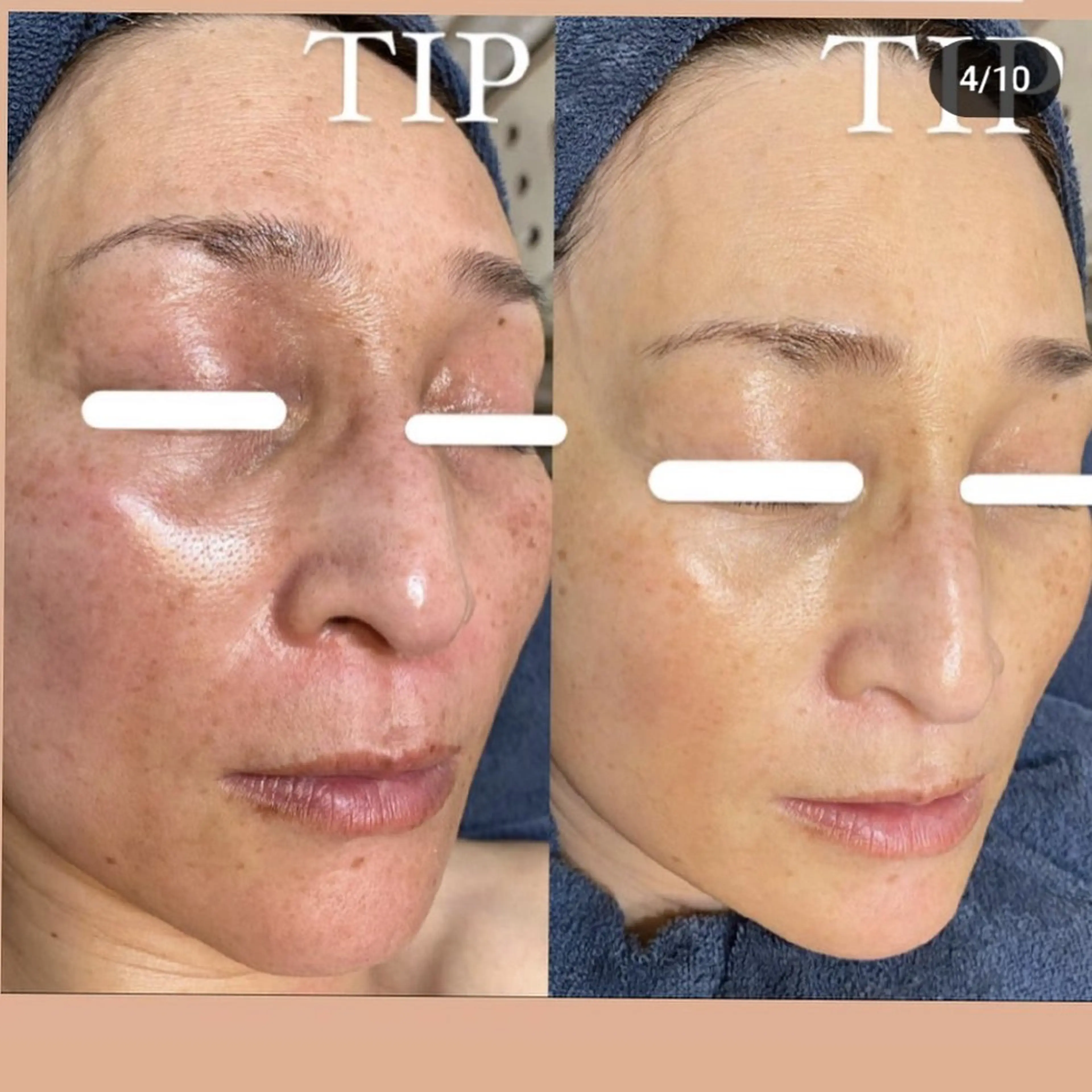 エステ Ellebeauty relaxationのエステ・リラクイメージ