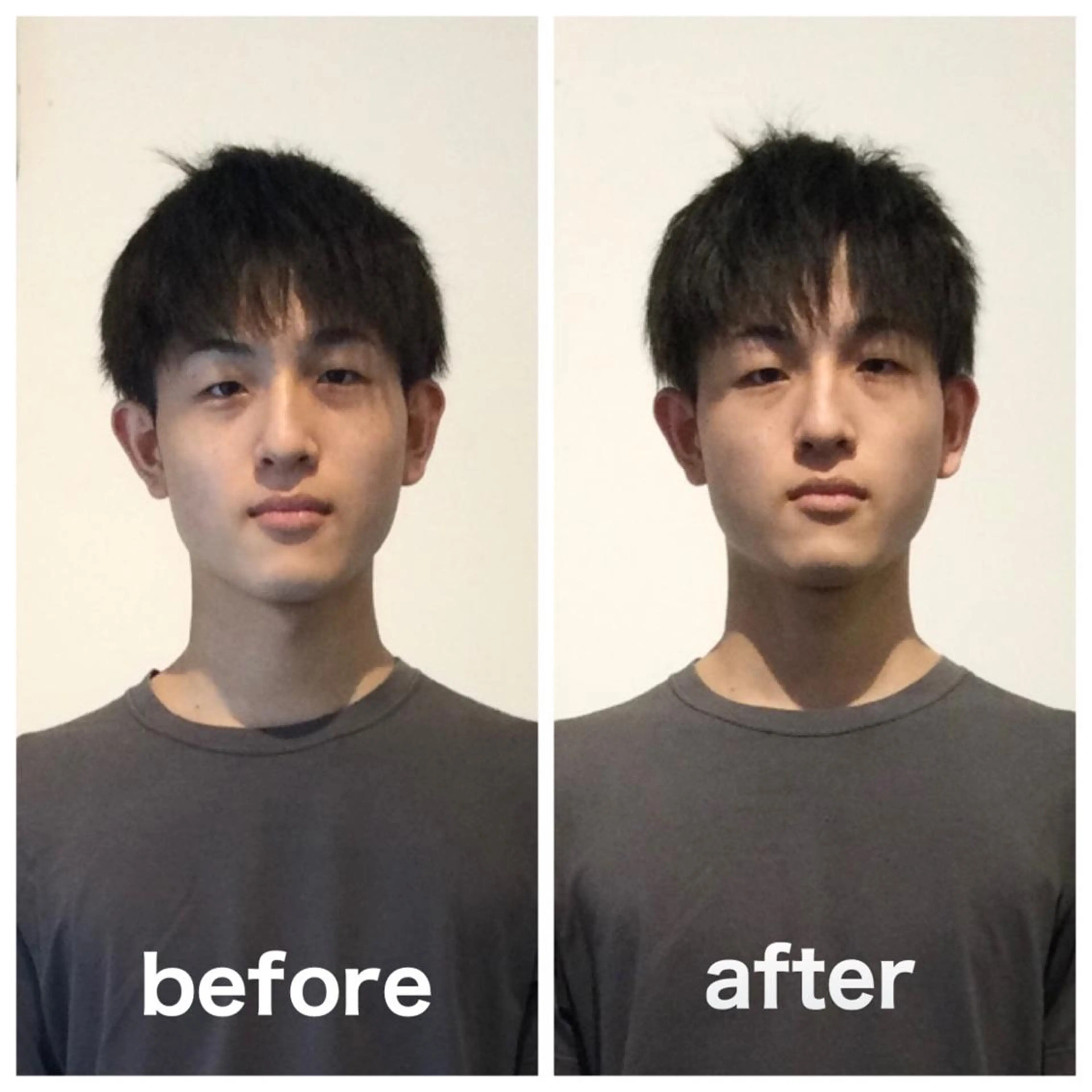 顔のたるみ・左右差/姿勢調整の写真