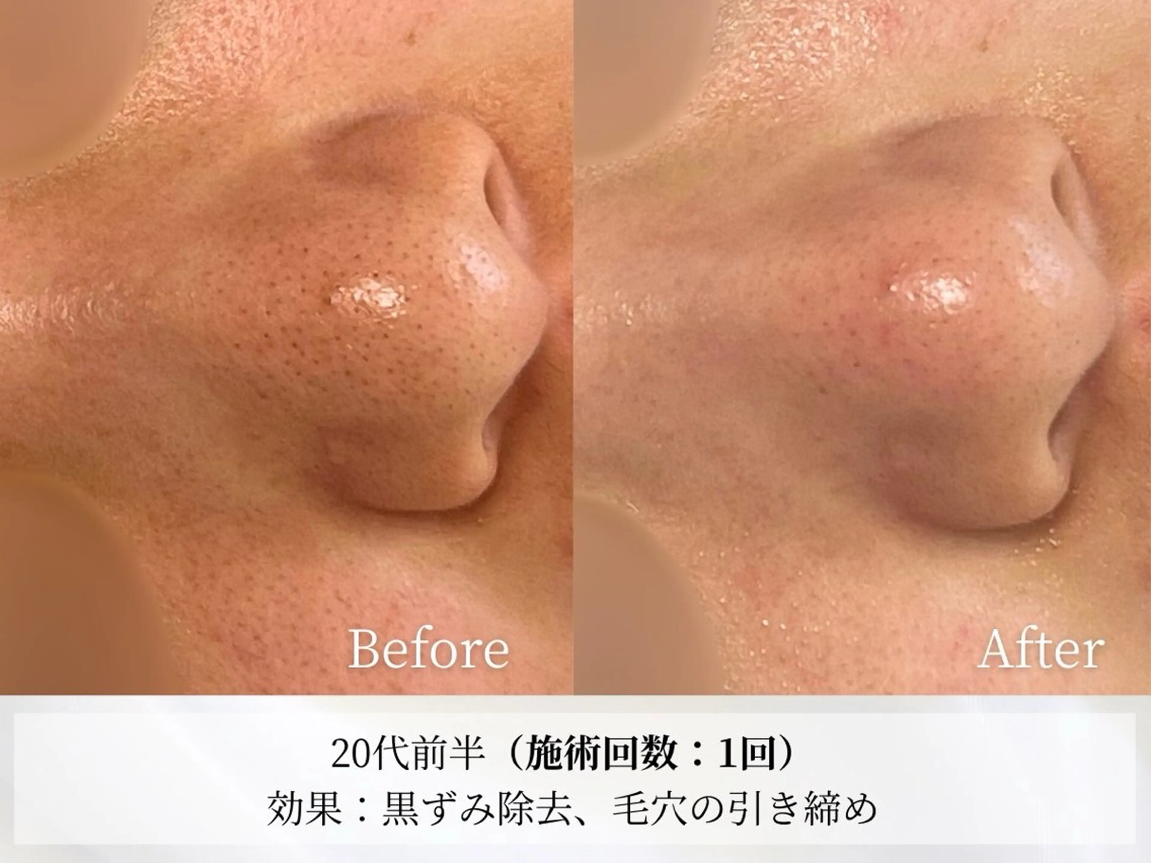 その他 Astorie 相模大野エステのその他イメージ