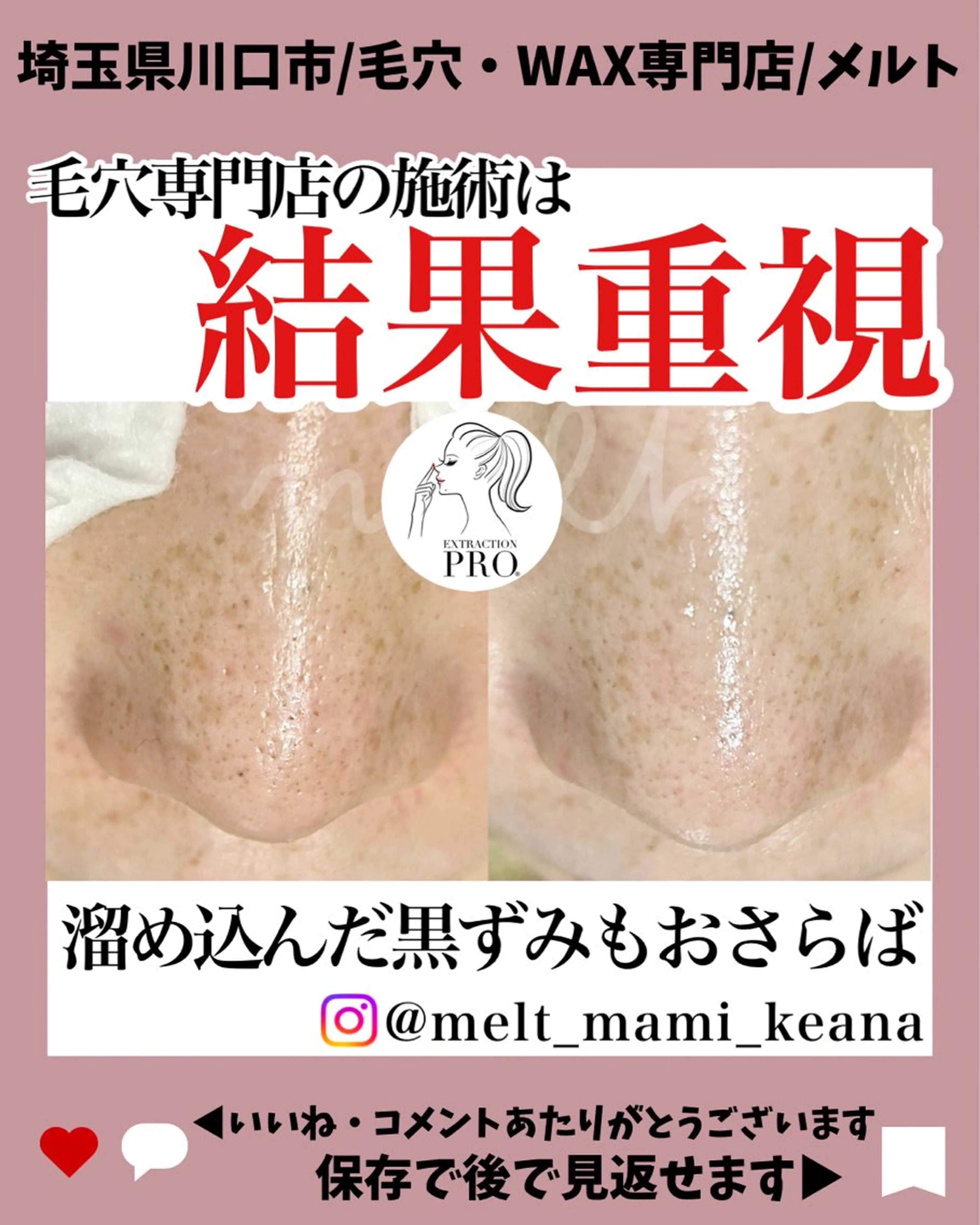 エステ melt まみのマツエク・マツパデザイン