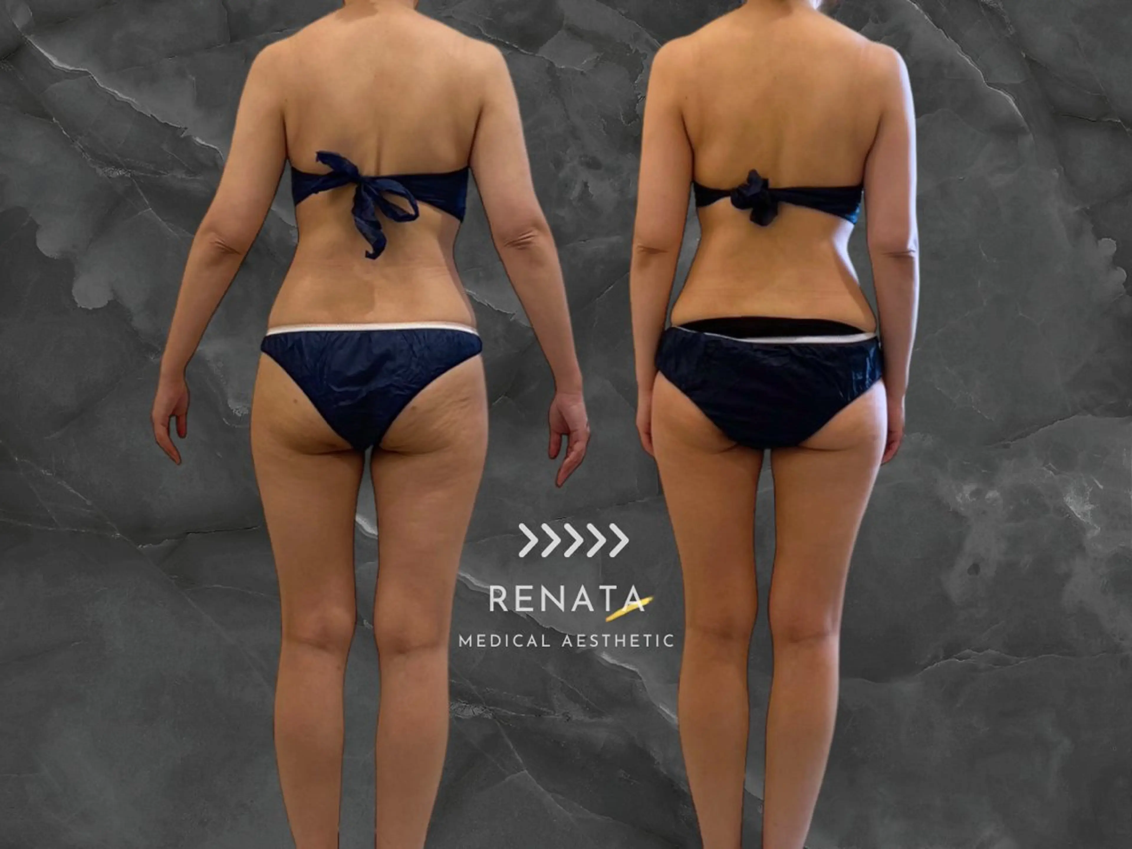 RENATA🕊 脂肪冷却専門店六本木のエステ・リラクイメージ