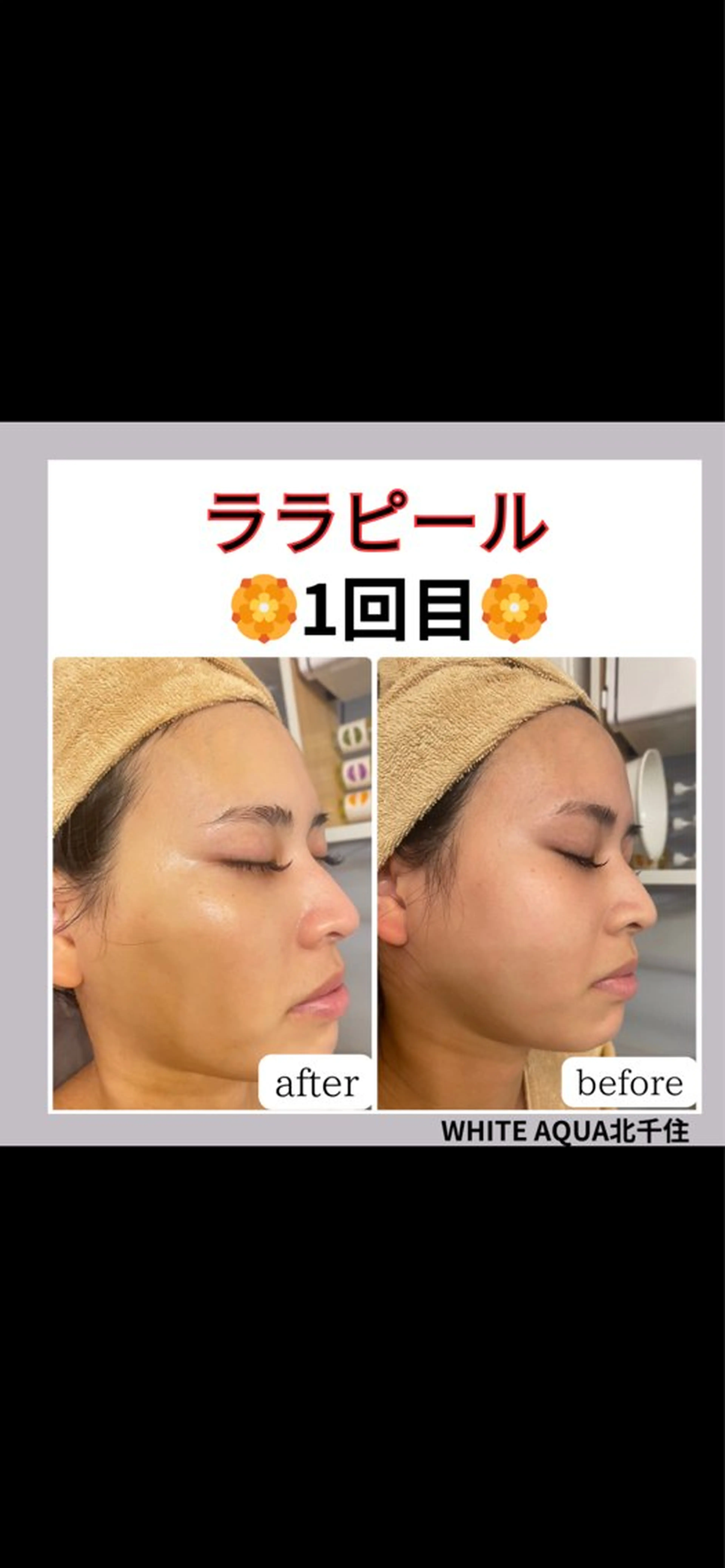 WHITE AQUA 北千住店のエステ・リラクイメージ