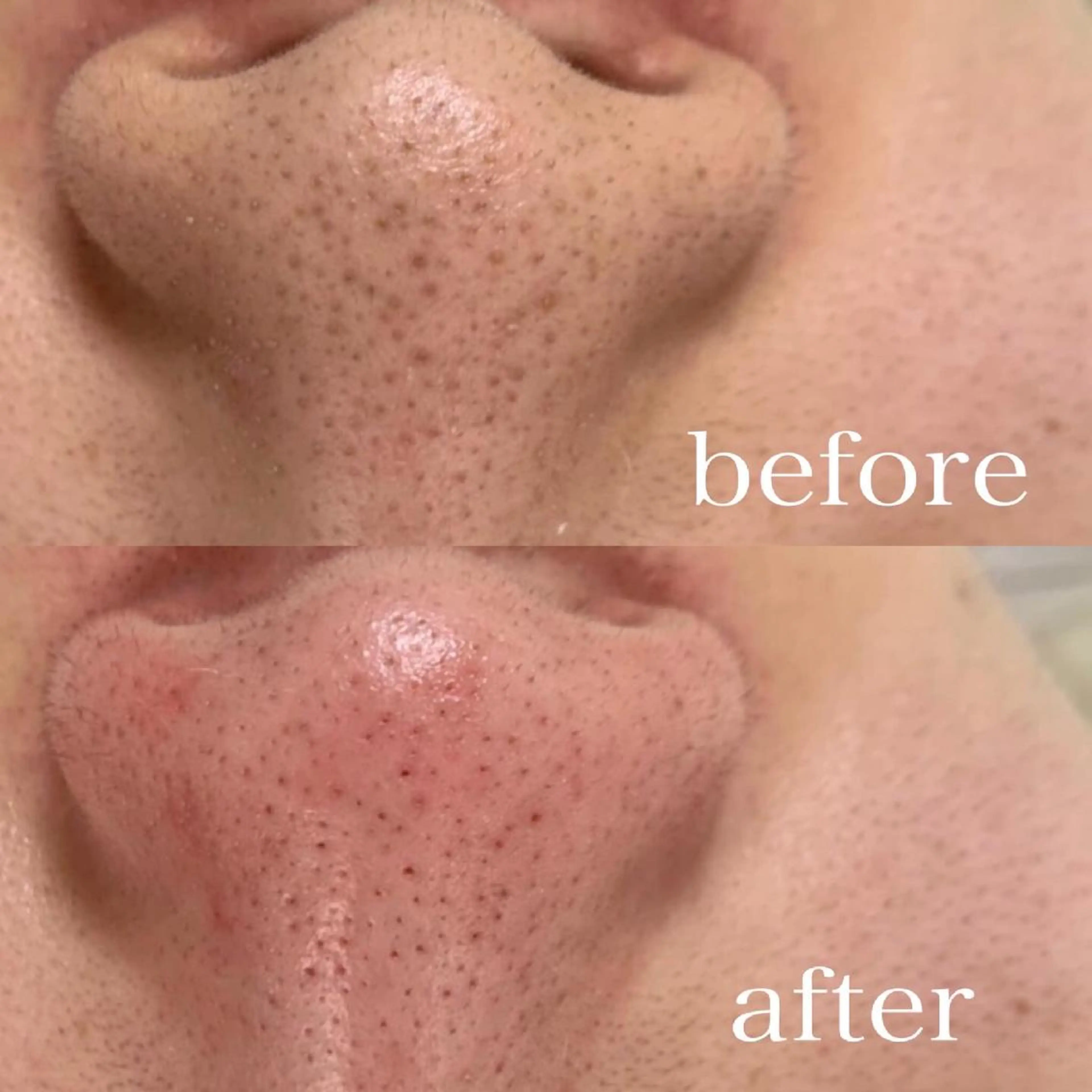 Petitmaison所属・Petit maisonのネイルデザイン