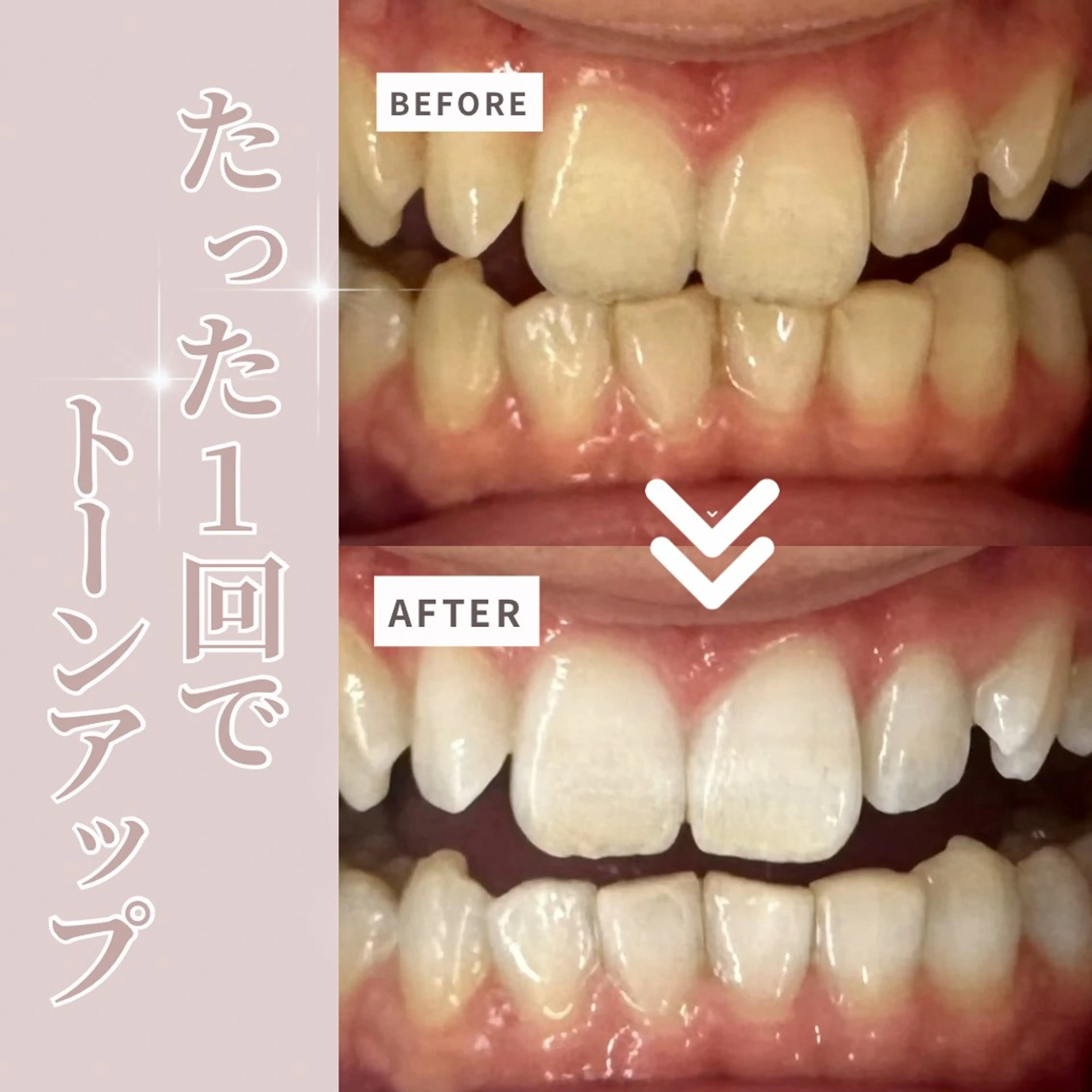 その他 LIBRA自由が丘所属・LIBRA自由が丘 ホワイトニングのその他イメージ