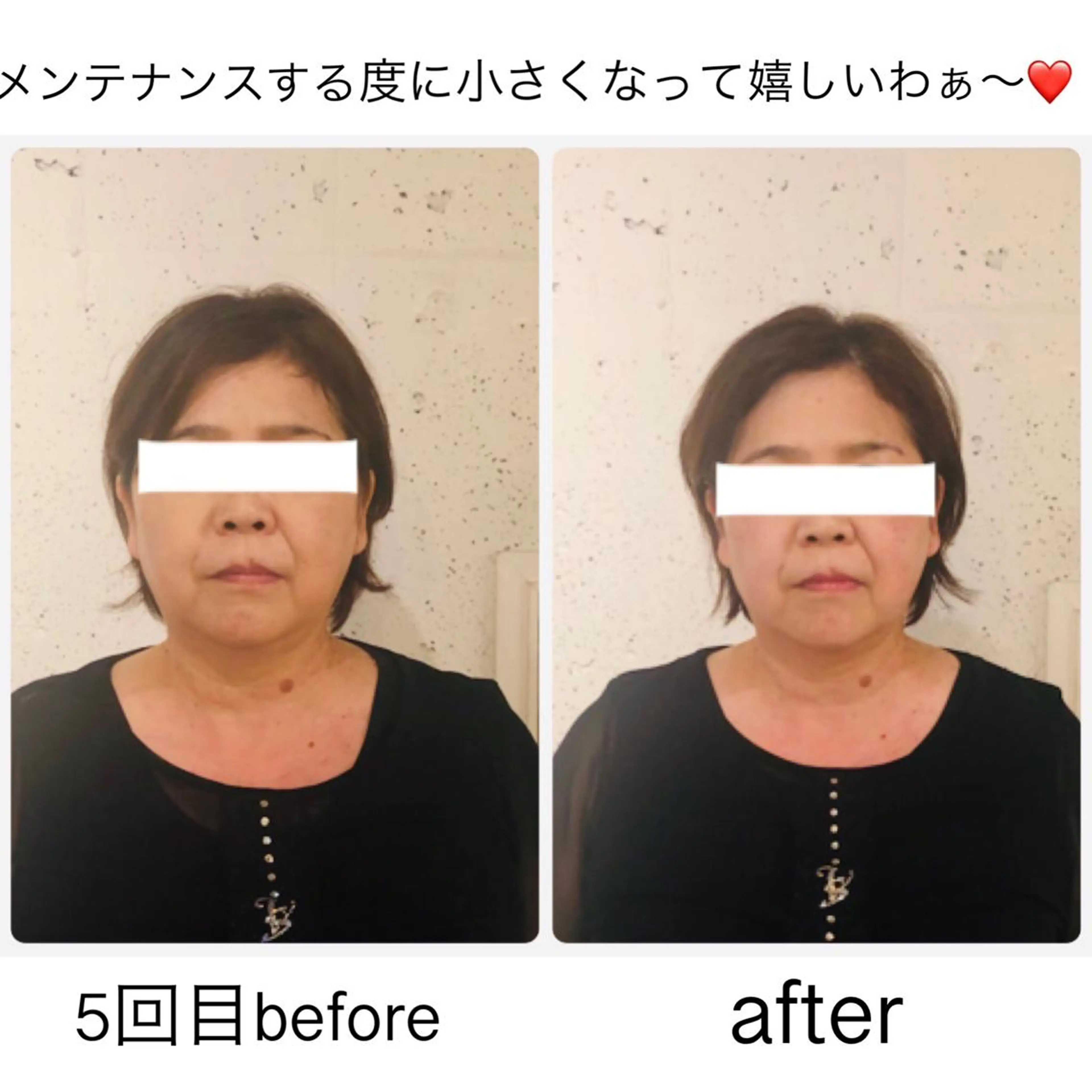 ショート カラー ネイル 小顔矯正専門サロンジュマリ所属・町田 淳子のエステ・リラクイメージ