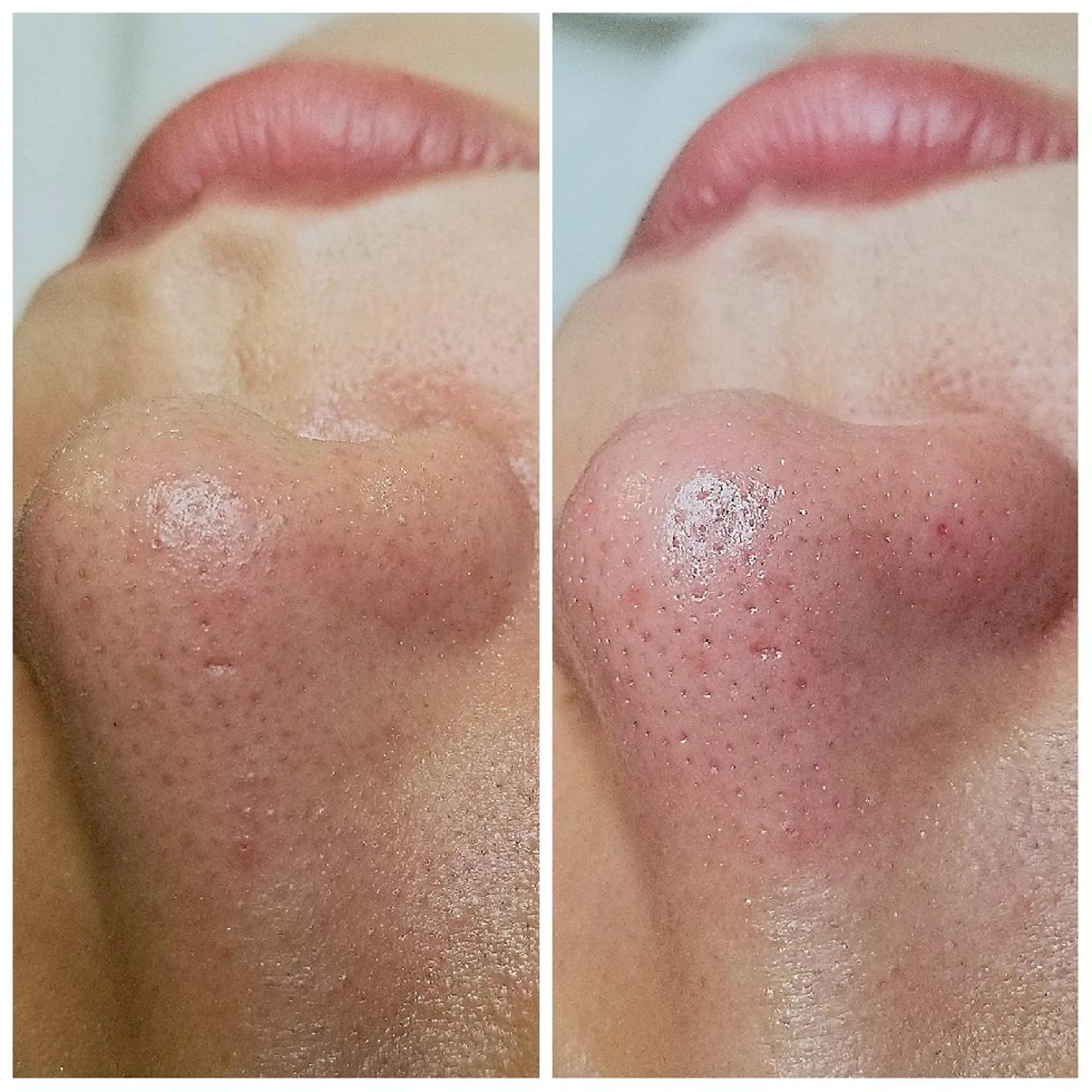 U_la所属・U_la [ウーラ] 片岡の眉毛・アイブロウイメージ