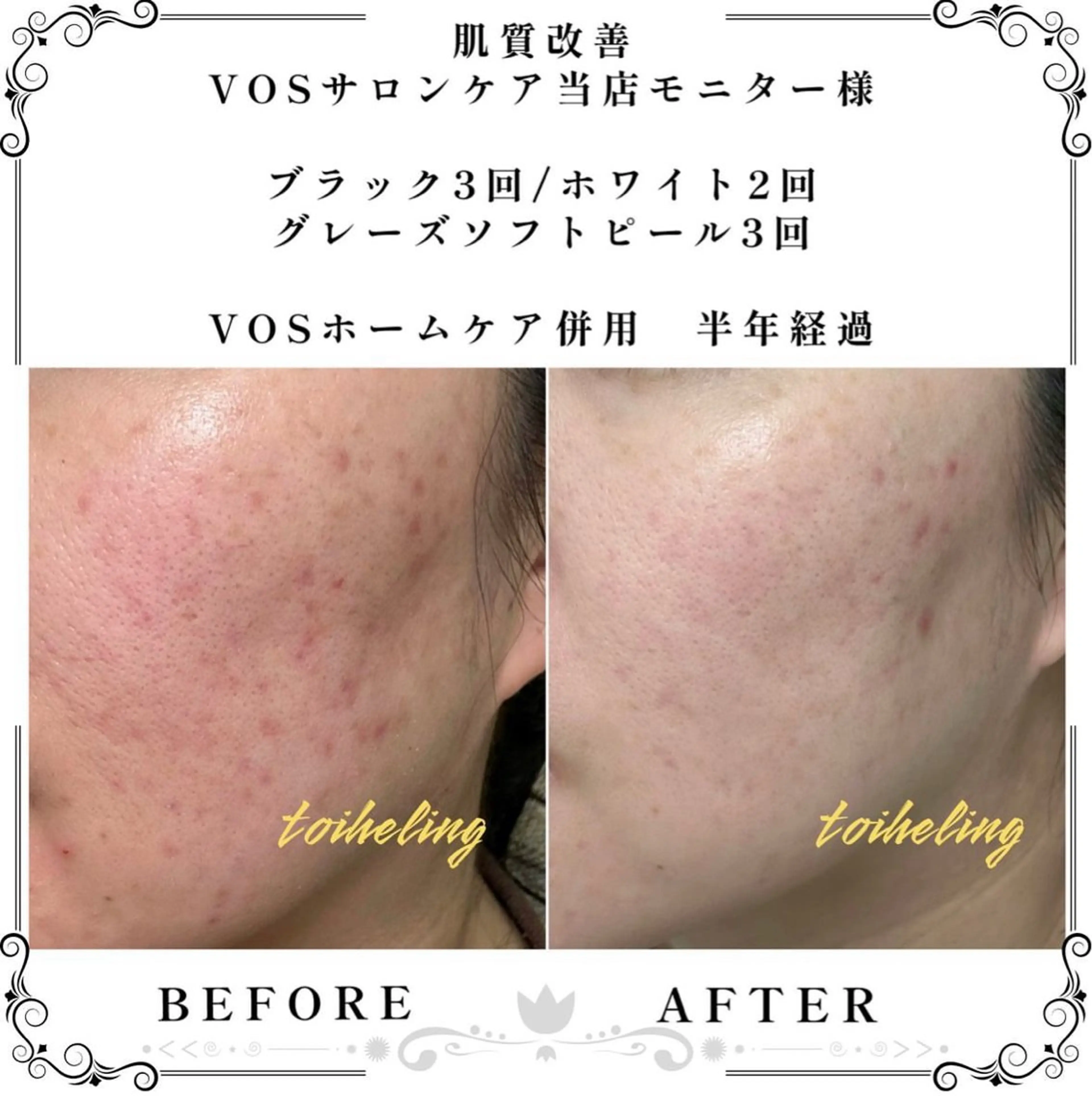 肌質改善サロン　toihealing所属・肌質改善サロン トワヒーリングのエステ・リラクイメージ