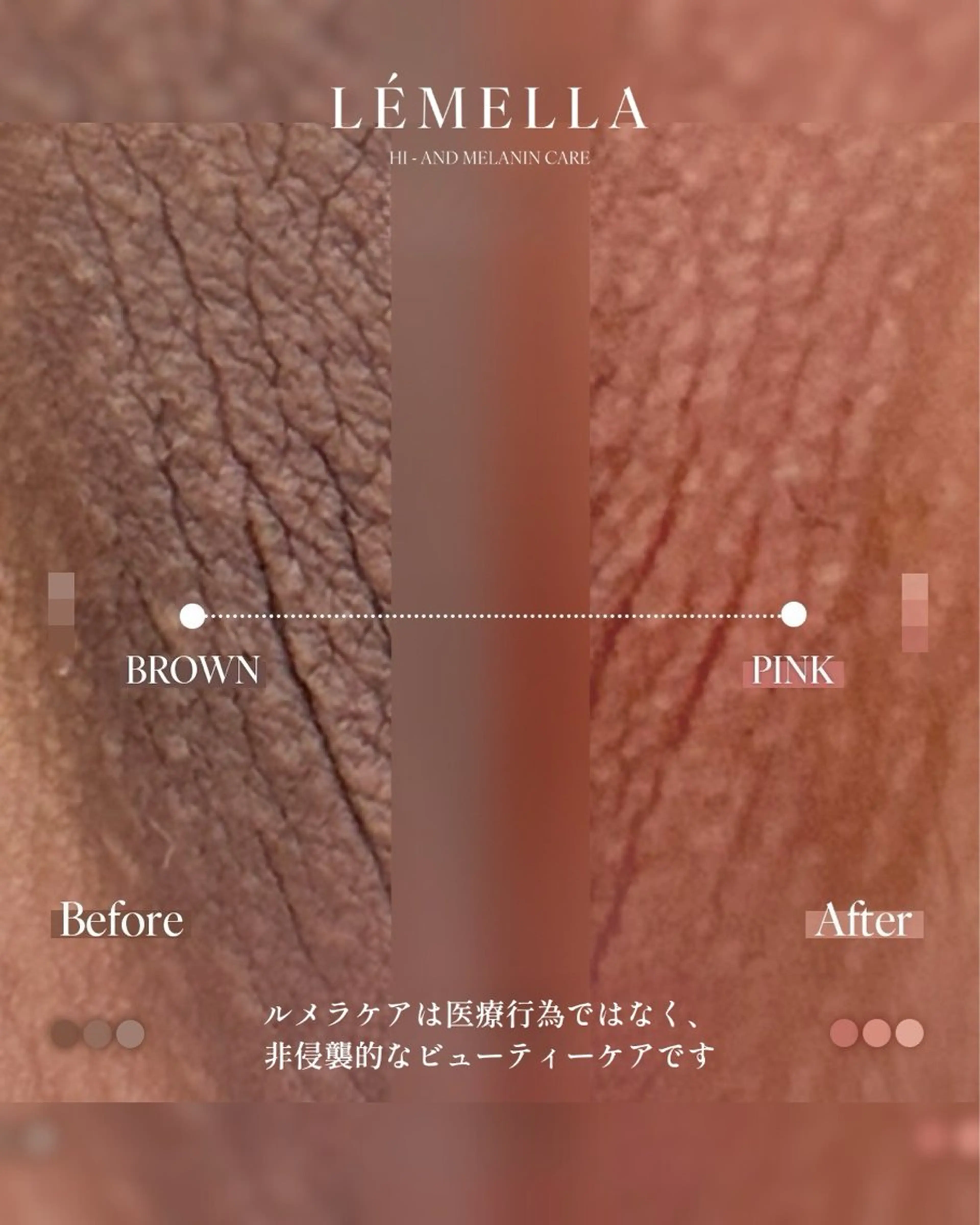 エステ リラク NAIL＆EYELASH SALON Lovers MOMO ～ラヴァーズ モモ～所属・Lovers MOMOのエステ・リラクイメージ