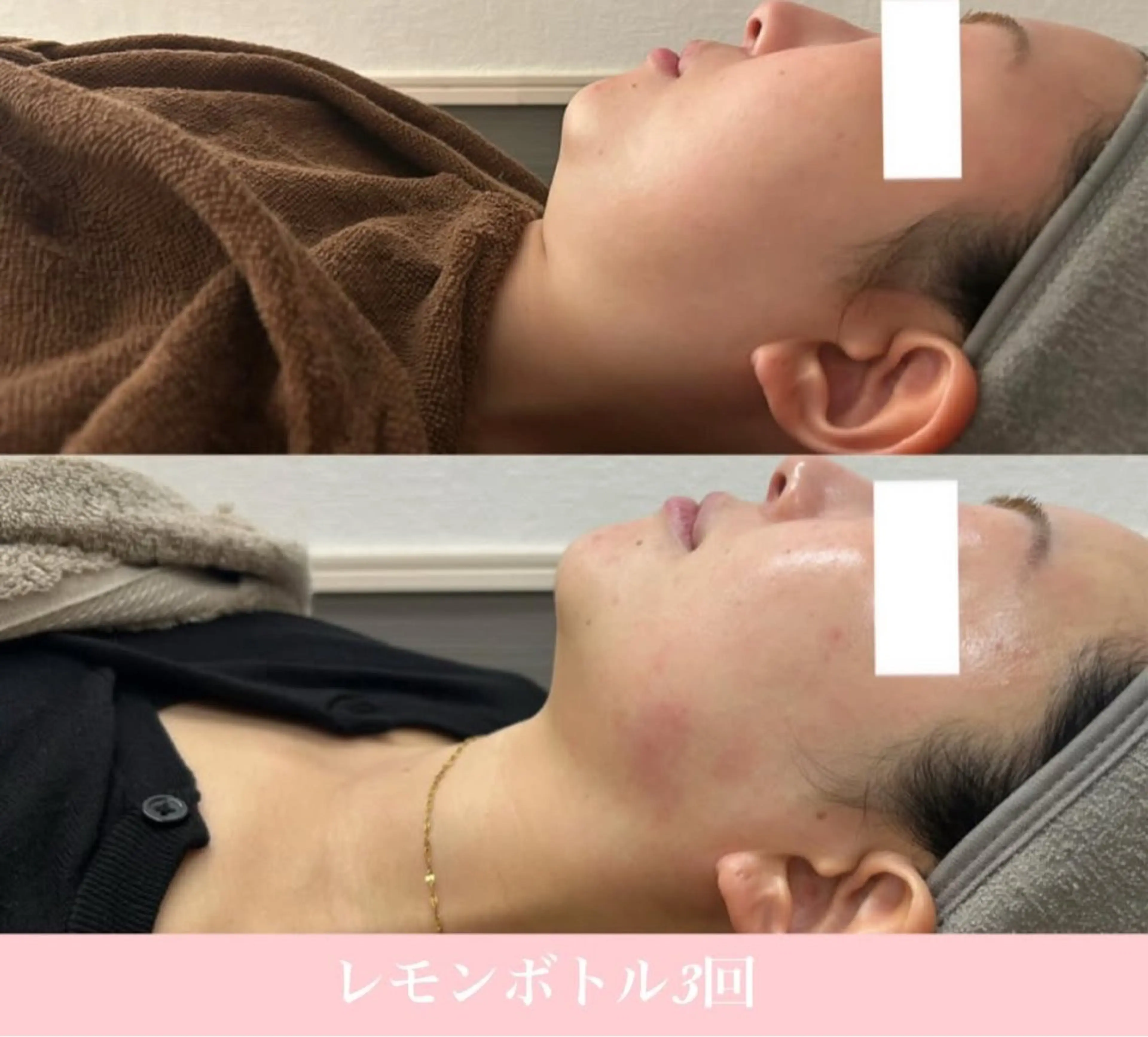 エステ 毛穴レス美肌へ🌿 看護師Abe🌼のエステ・リラクイメージ