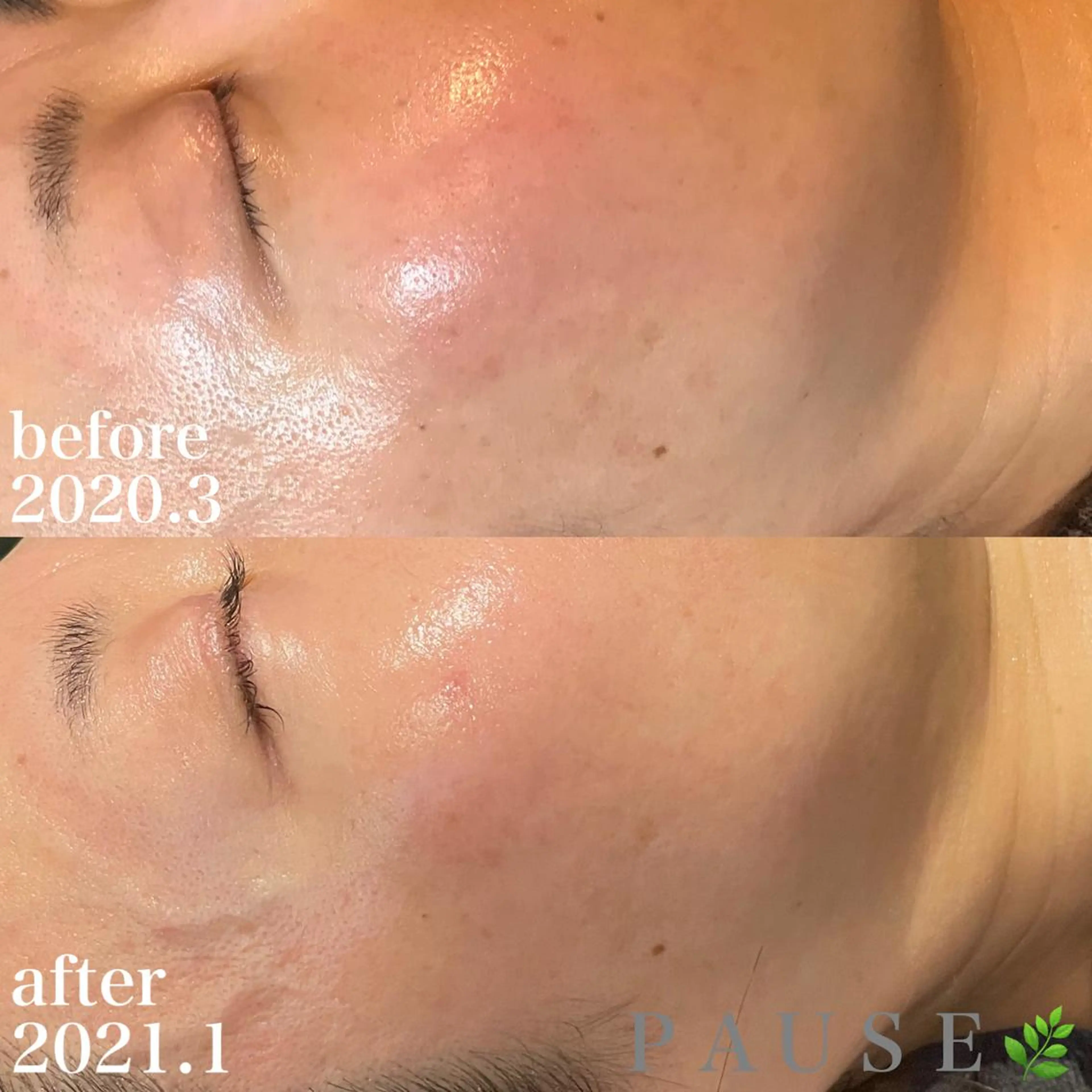 エステ 浜野 恵美のエステ・リラクイメージ