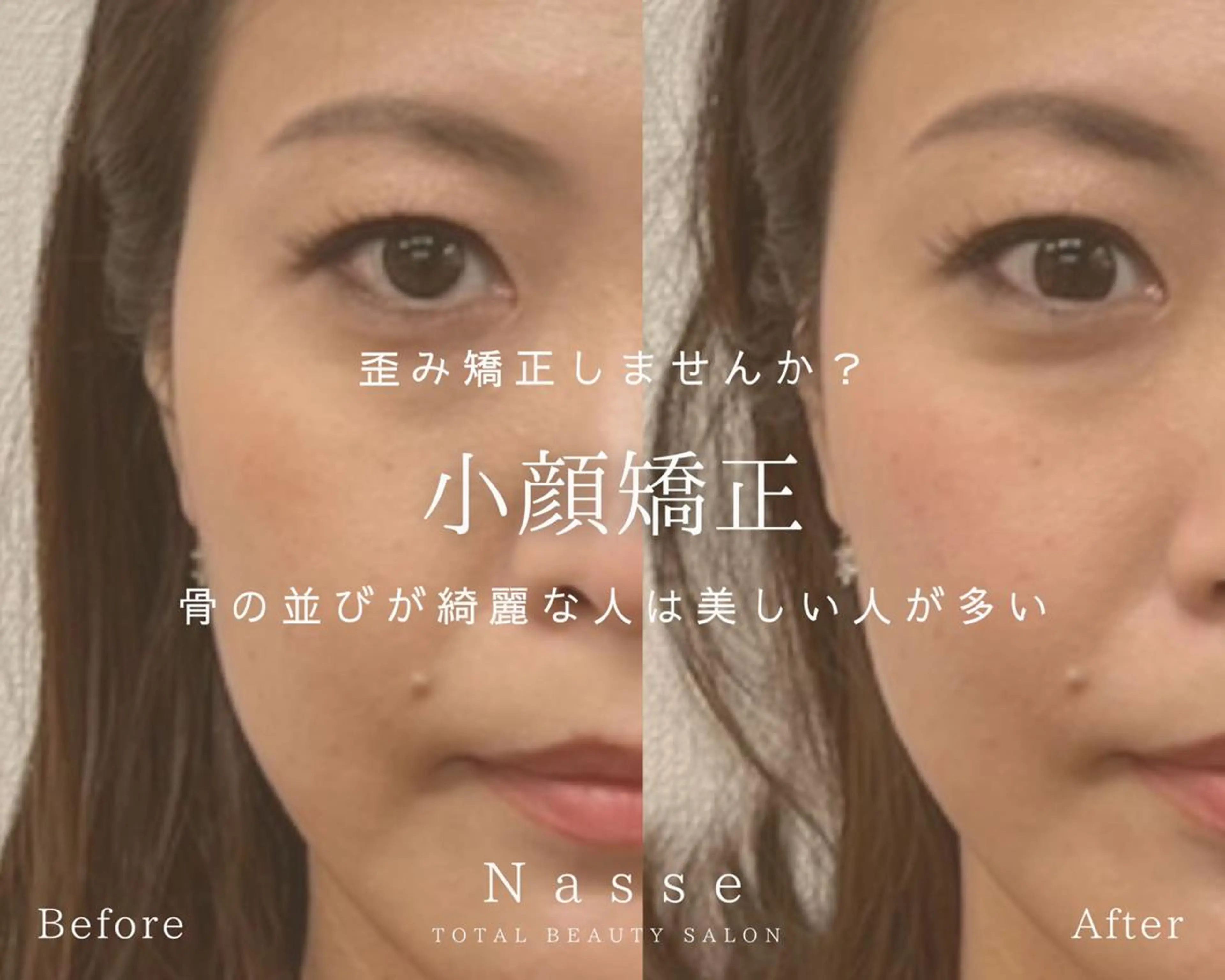 ✨即効小顔✨ゆるみ＆歪み改善・最強小顔矯正💎　美容整骨矯正　\6600　[福岡/赤坂]の写真