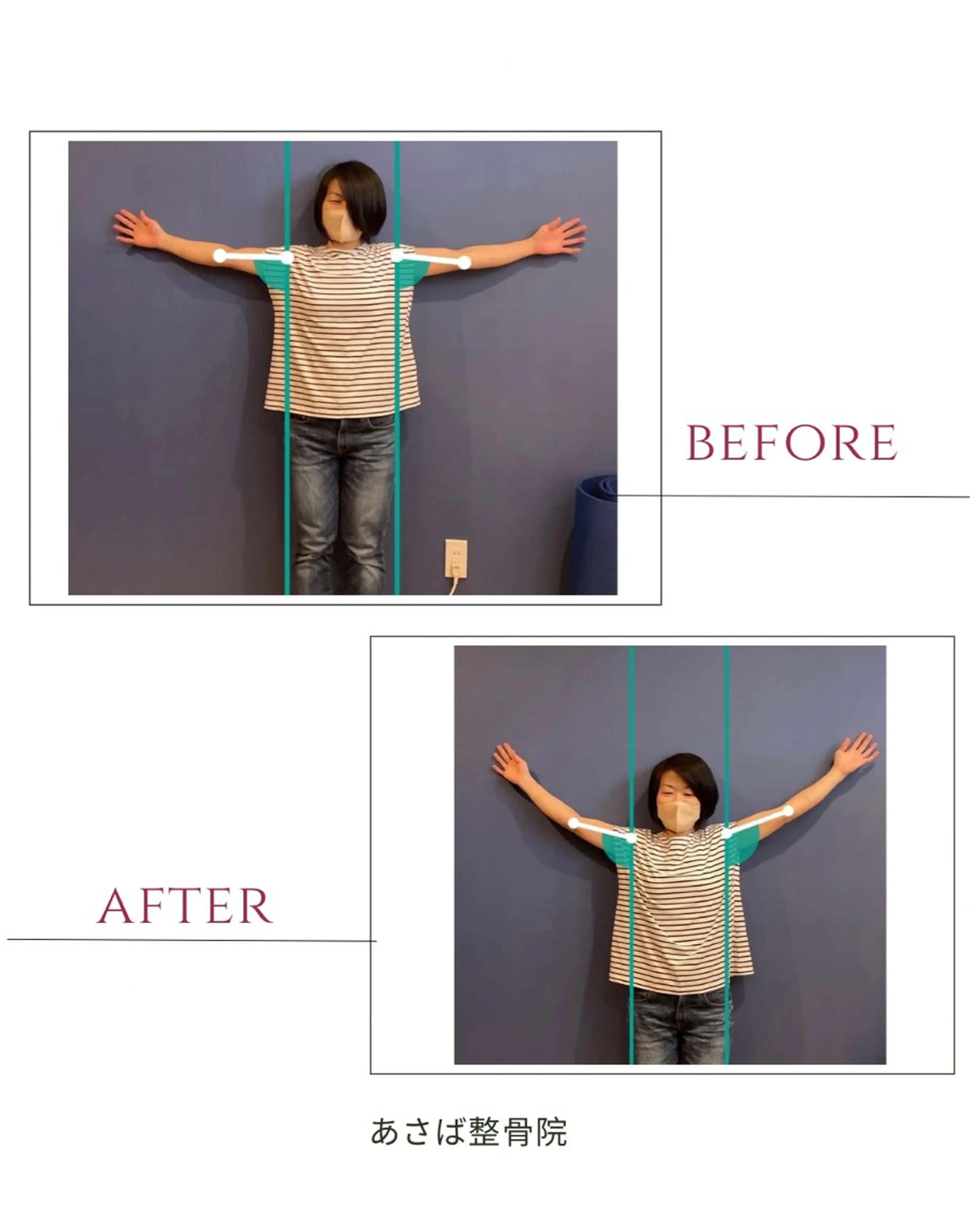 【🆕肩こり・首コリおすすめ🆕】肩甲骨はがし 20分3,300円→０円の写真