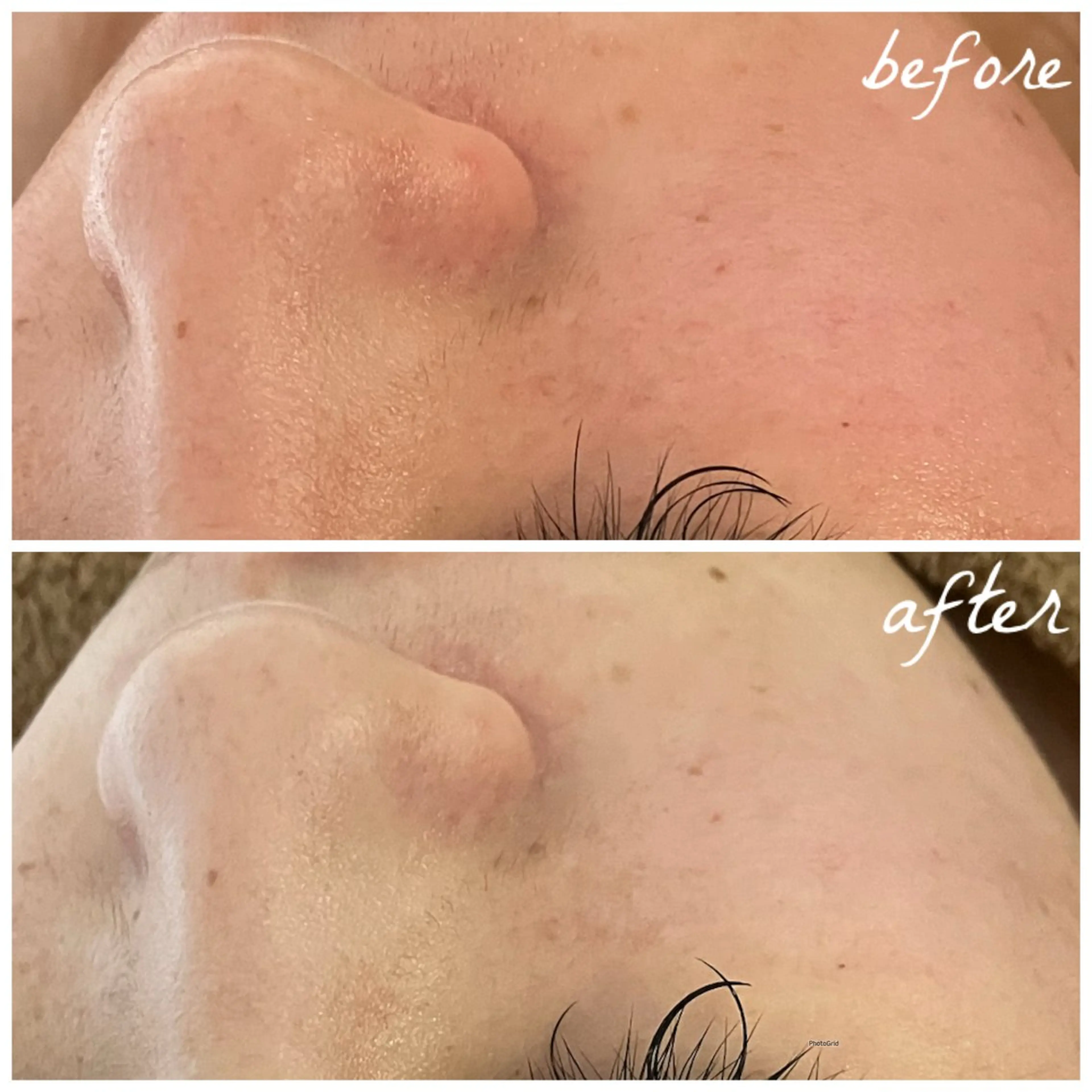 メンズ エステ メナード岐阜茜部 杉浦のエステ・リラクイメージ