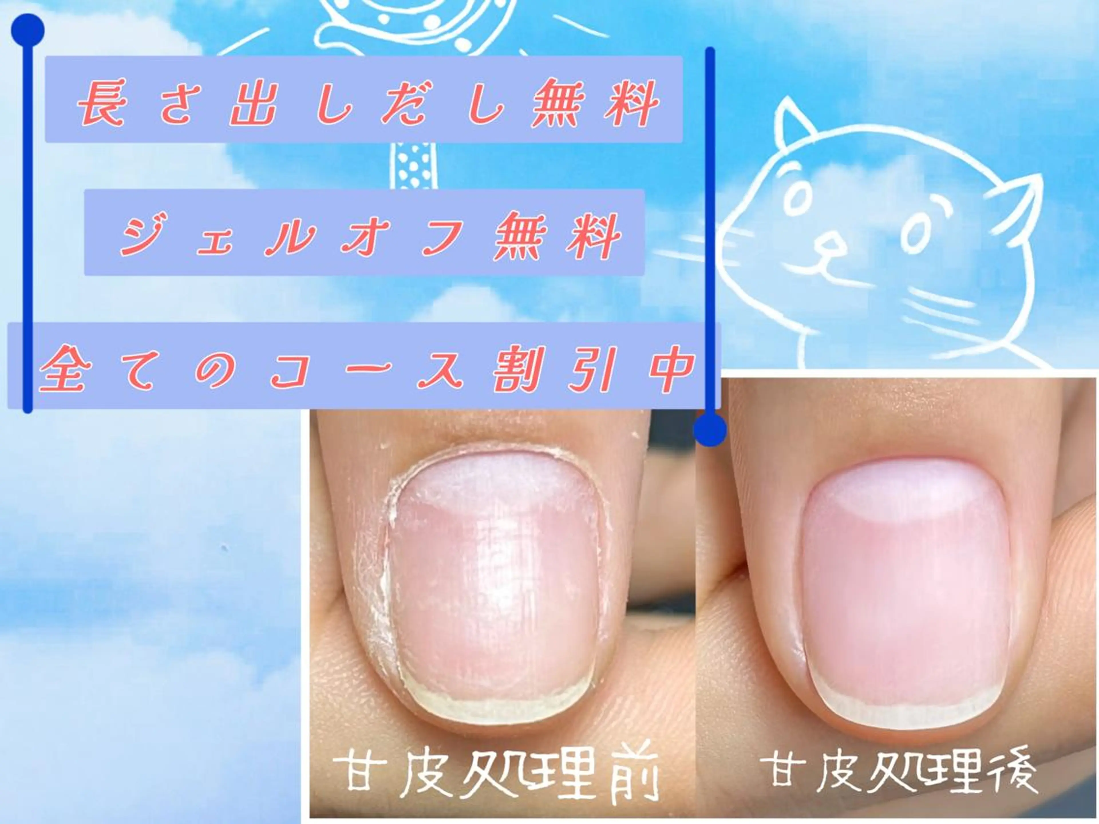 ネイル NFY-あや nailforyouのネイルデザイン