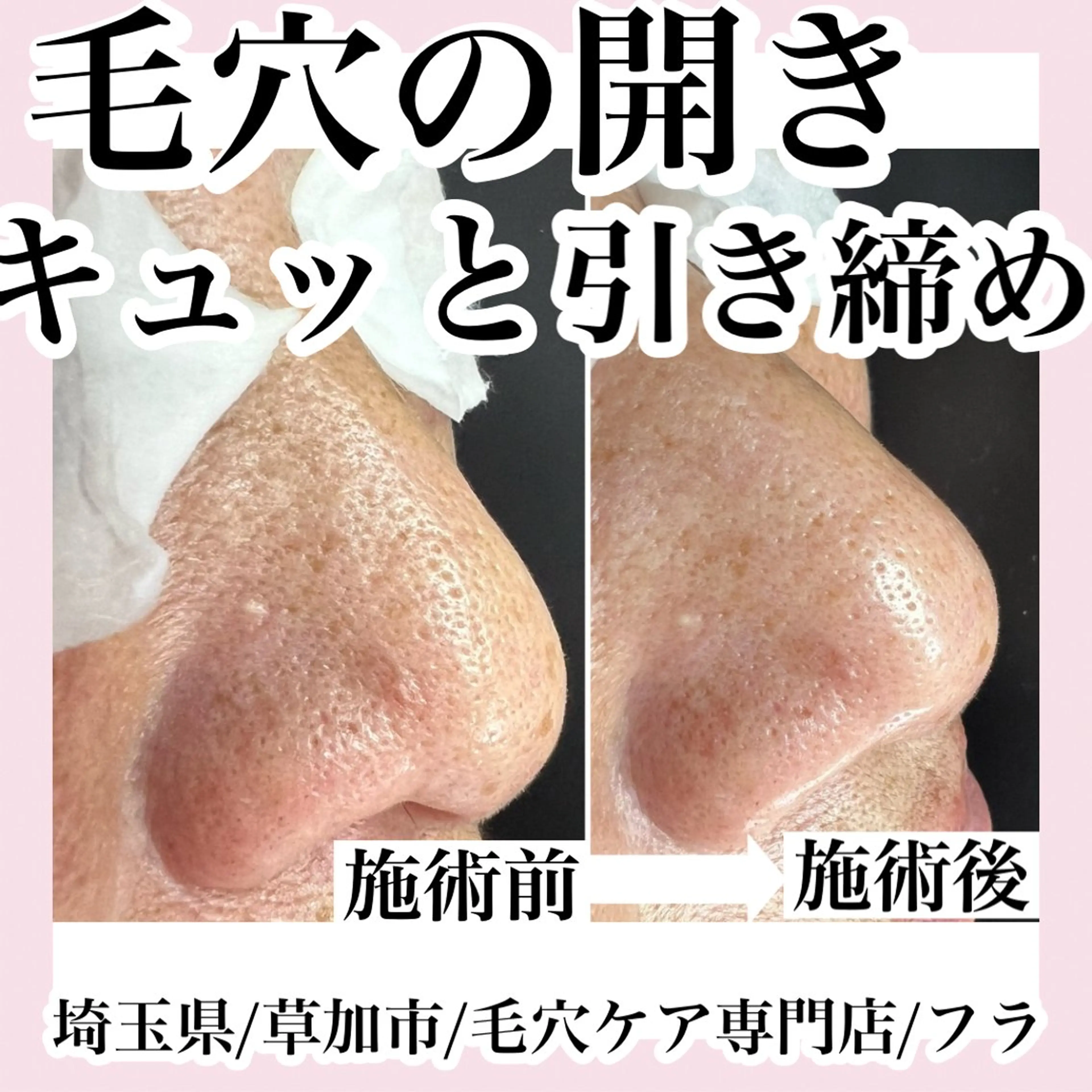 エステ 毛穴専門店hula 杉山智美のエステ・リラクイメージ