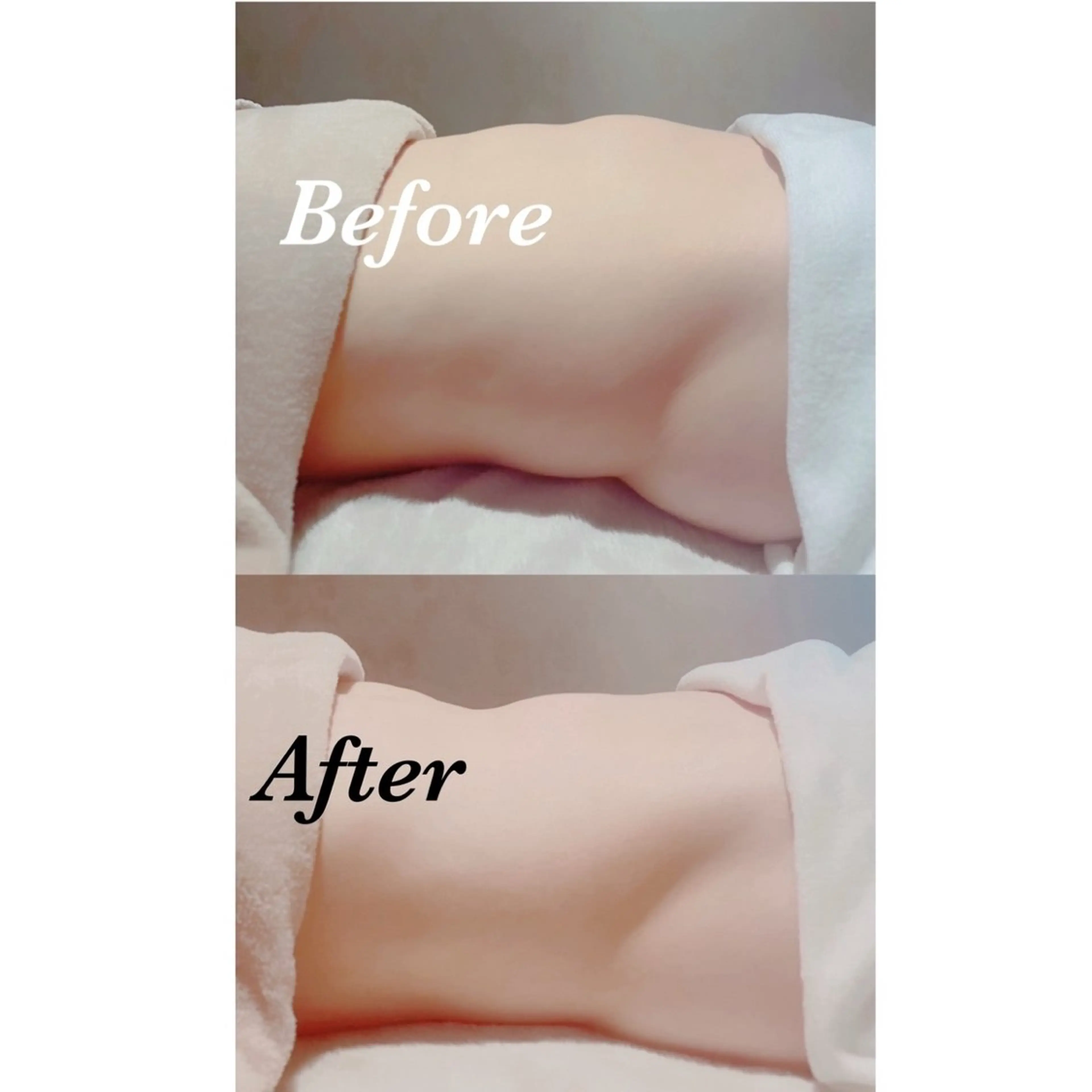【さよなら便秘】腸もみおなかエステの写真