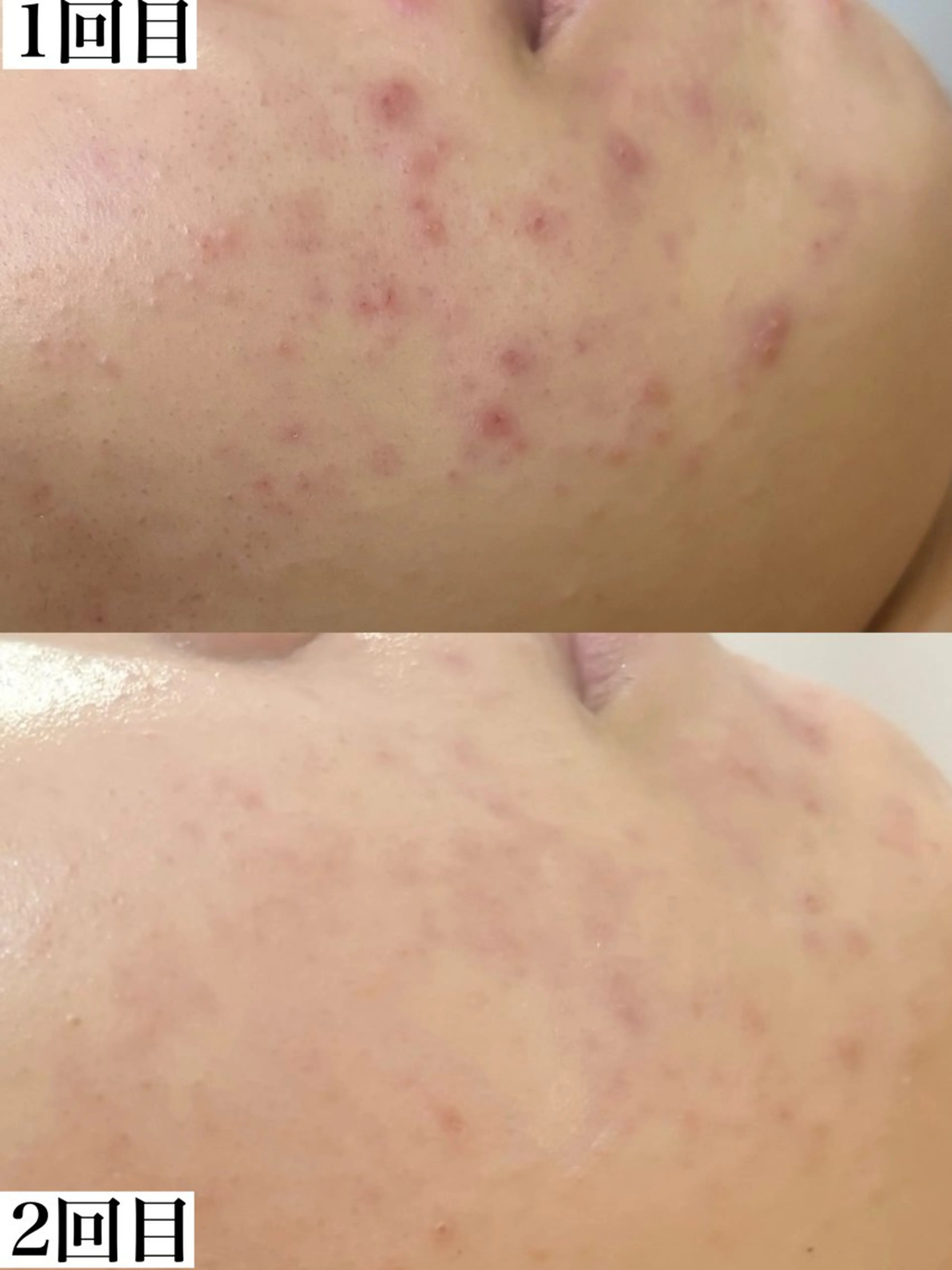 エステ WHITE AQUA 北千住店のエステ・リラクイメージ