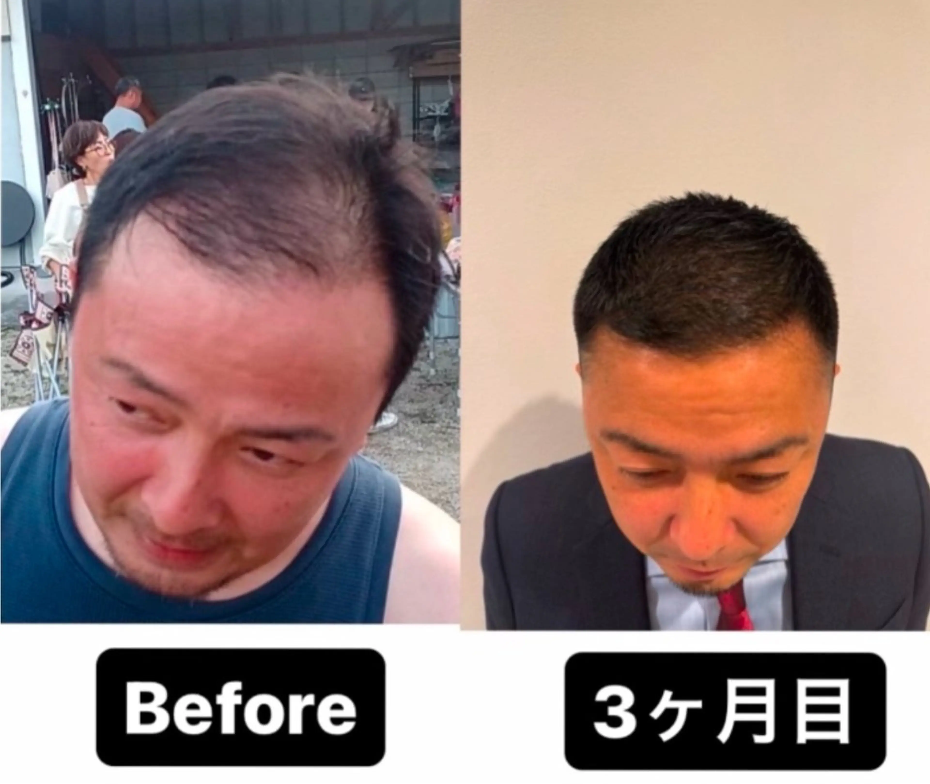 40代からの髪悩み 専門美髪アドバイザーのヘアスタイル