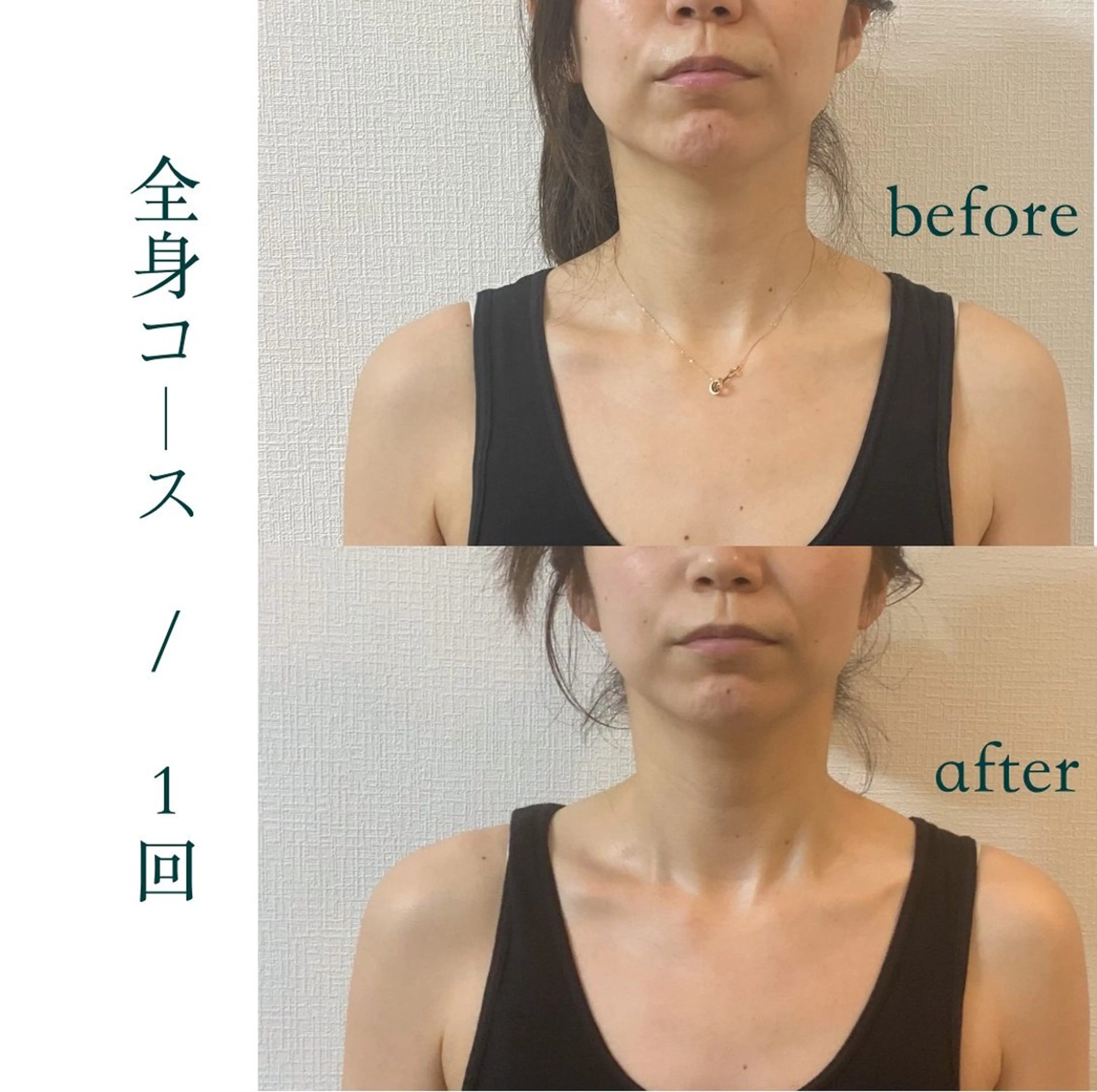 小顔&美容矯正 サロン🌿Miloのエステ・リラクイメージ