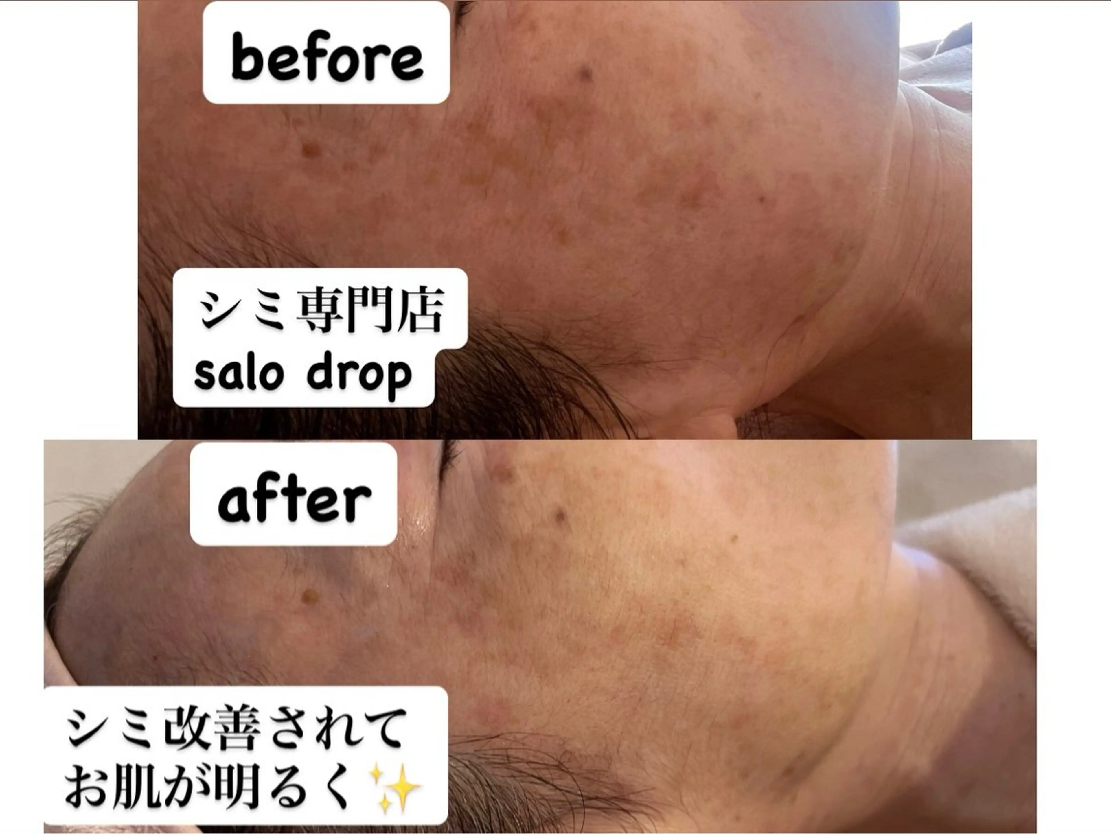 salon＿drop所属・salon dropのエステ・リラクイメージ