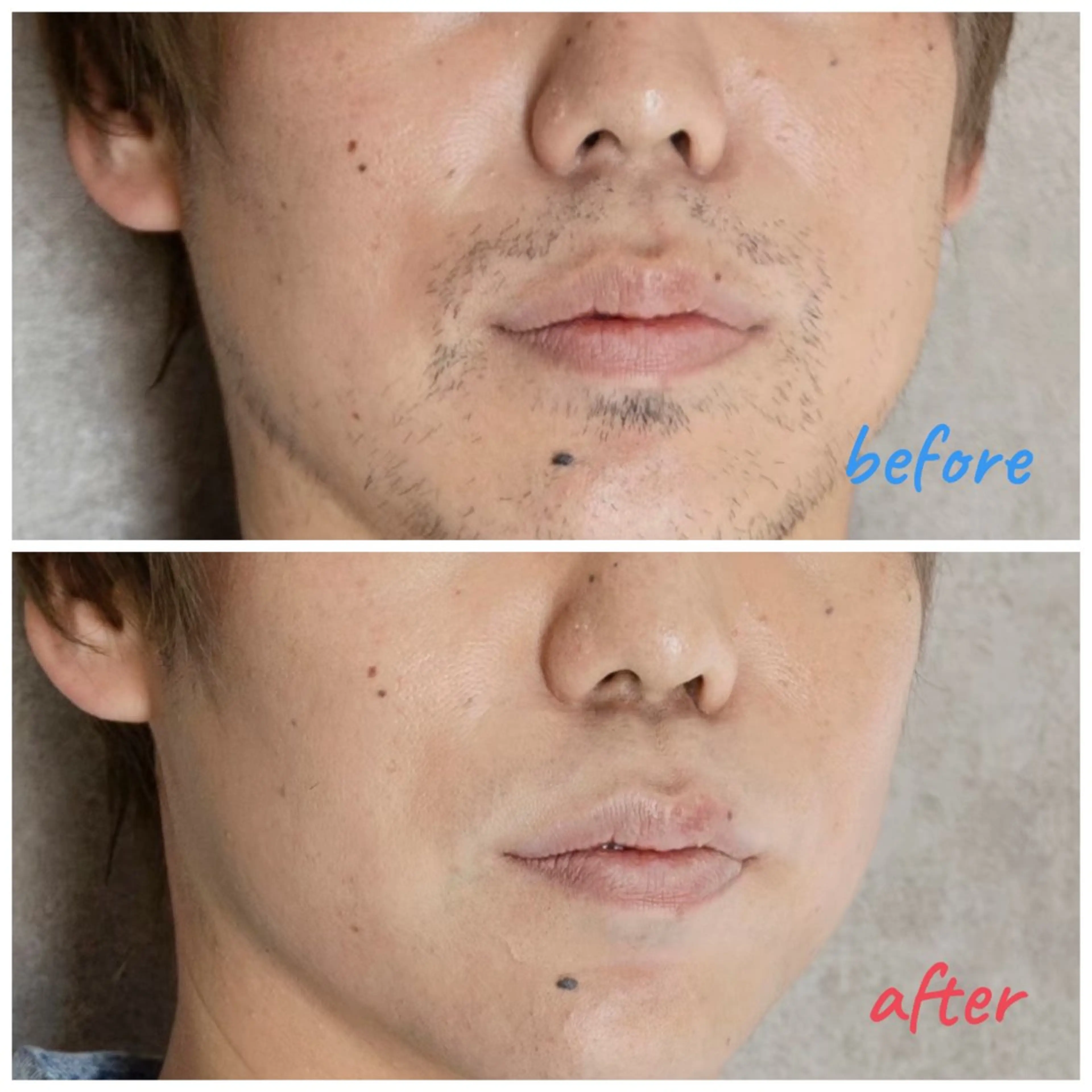 メンズ A.D LABO所属・A.D LABO yu-kaのエステ・リラクイメージ