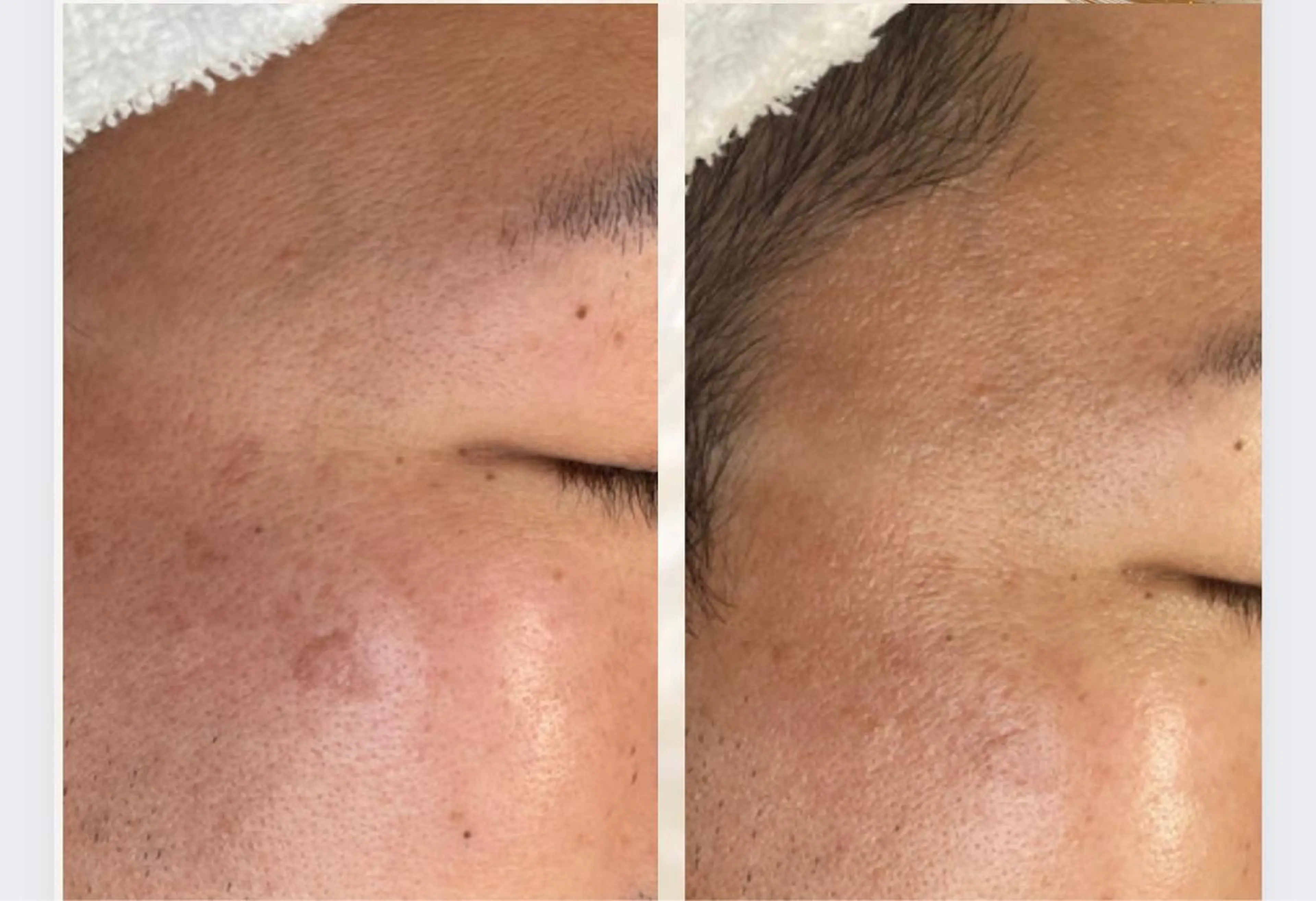 バストサロン BONBONのエステ・リラクイメージ