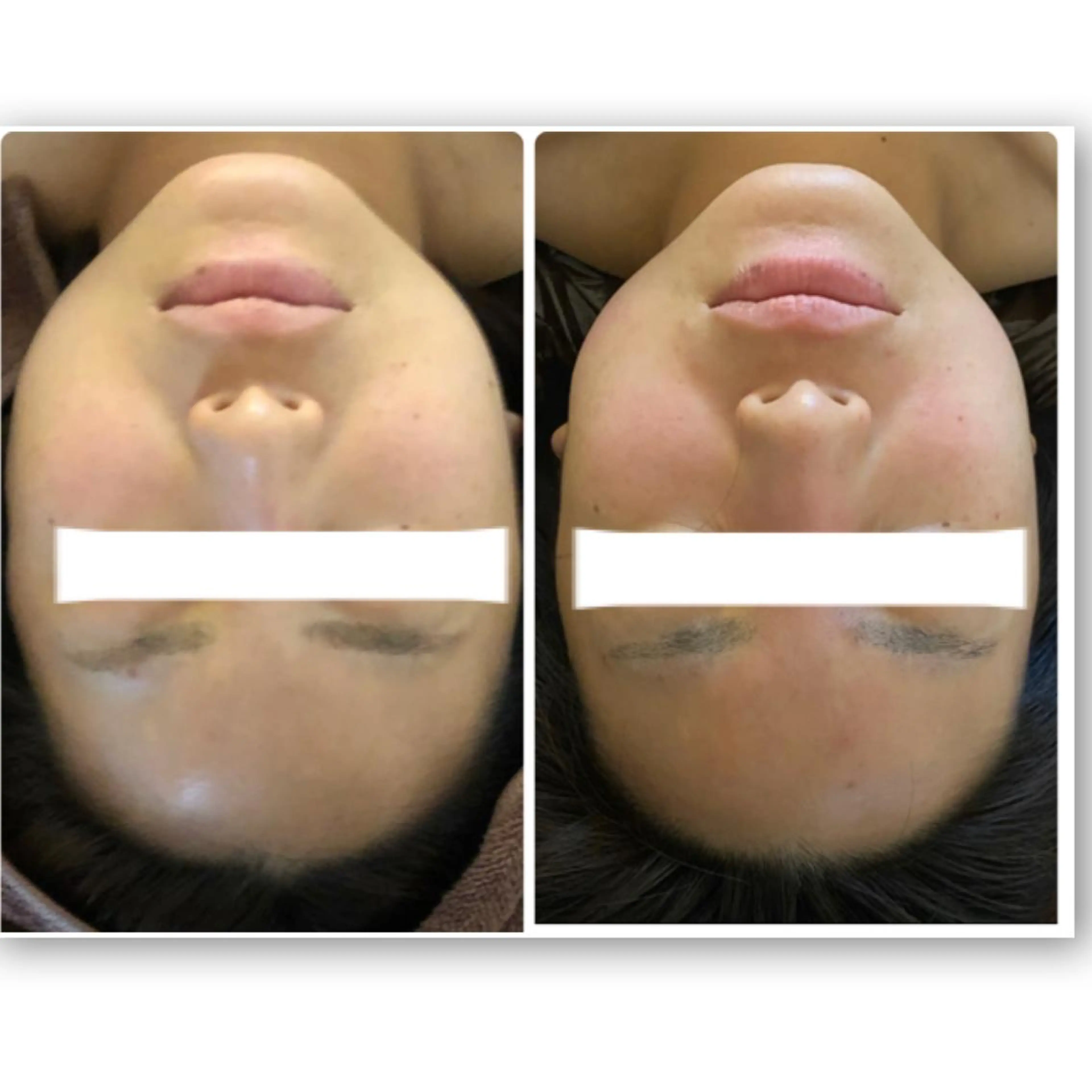 FLEUR大阪・整体 ・ハイフ・痩身・小顔のエステ・リラクイメージ