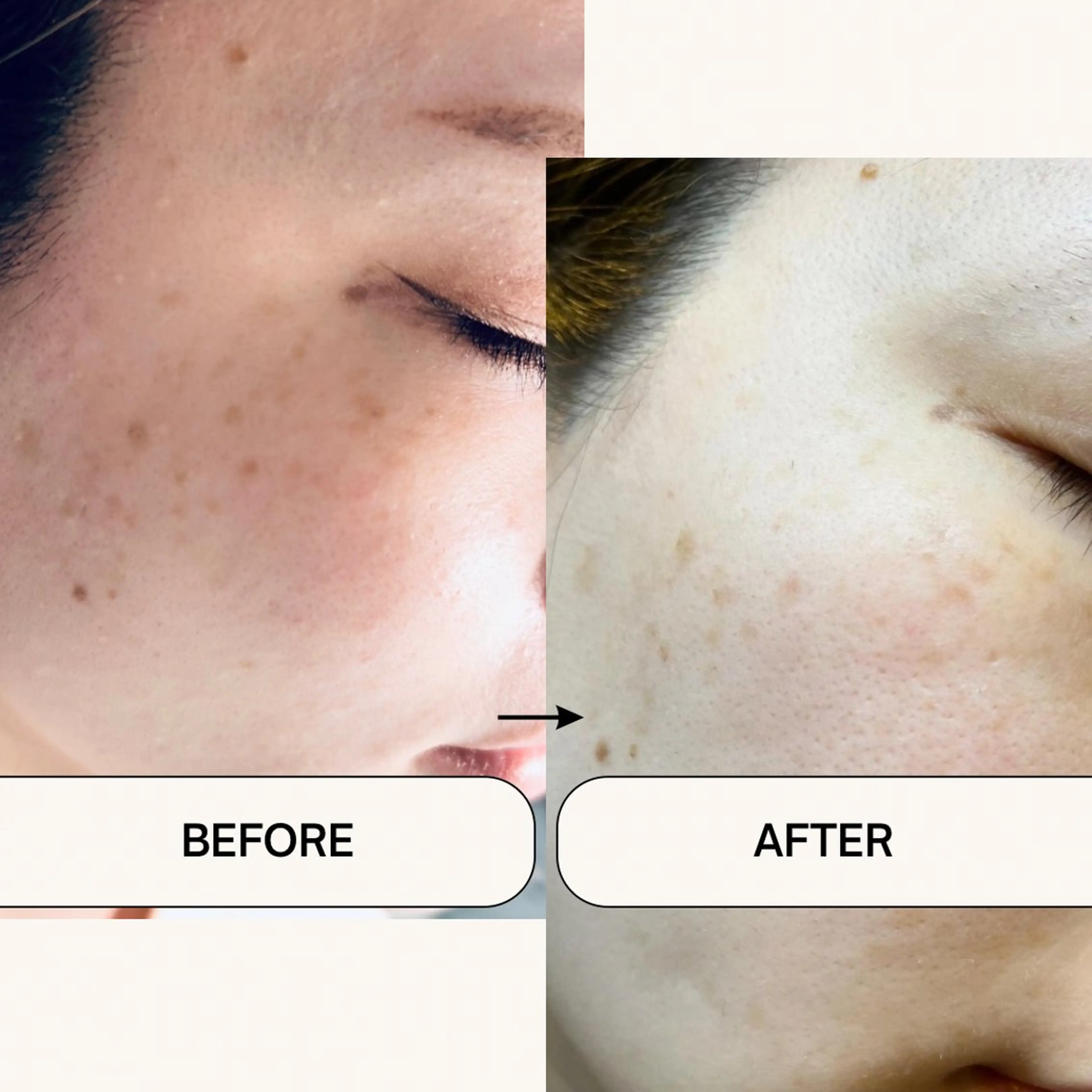 エステ N.style所属・Ｎ. styleのネイルデザイン