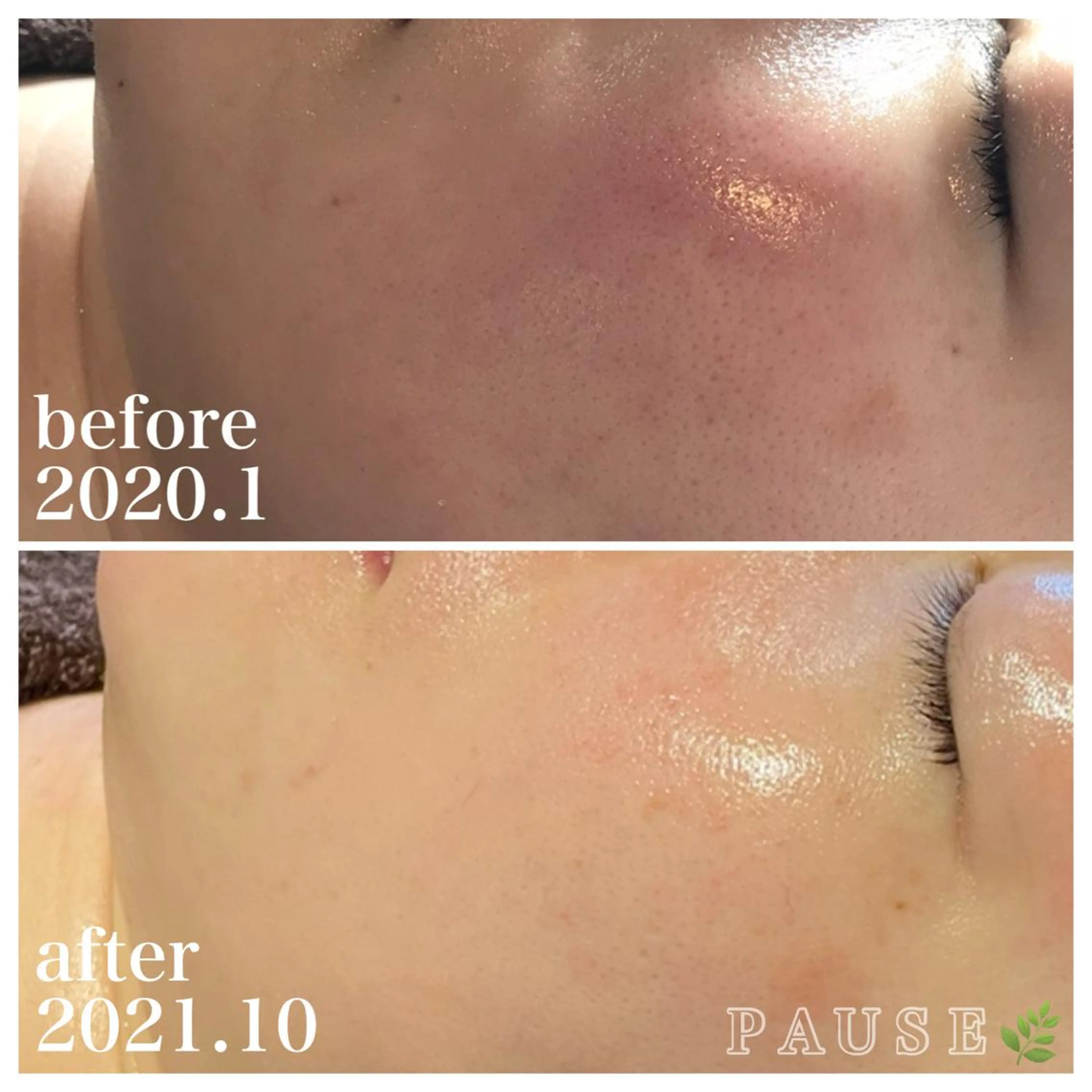 エステ 浜野 恵美のエステ・リラクイメージ