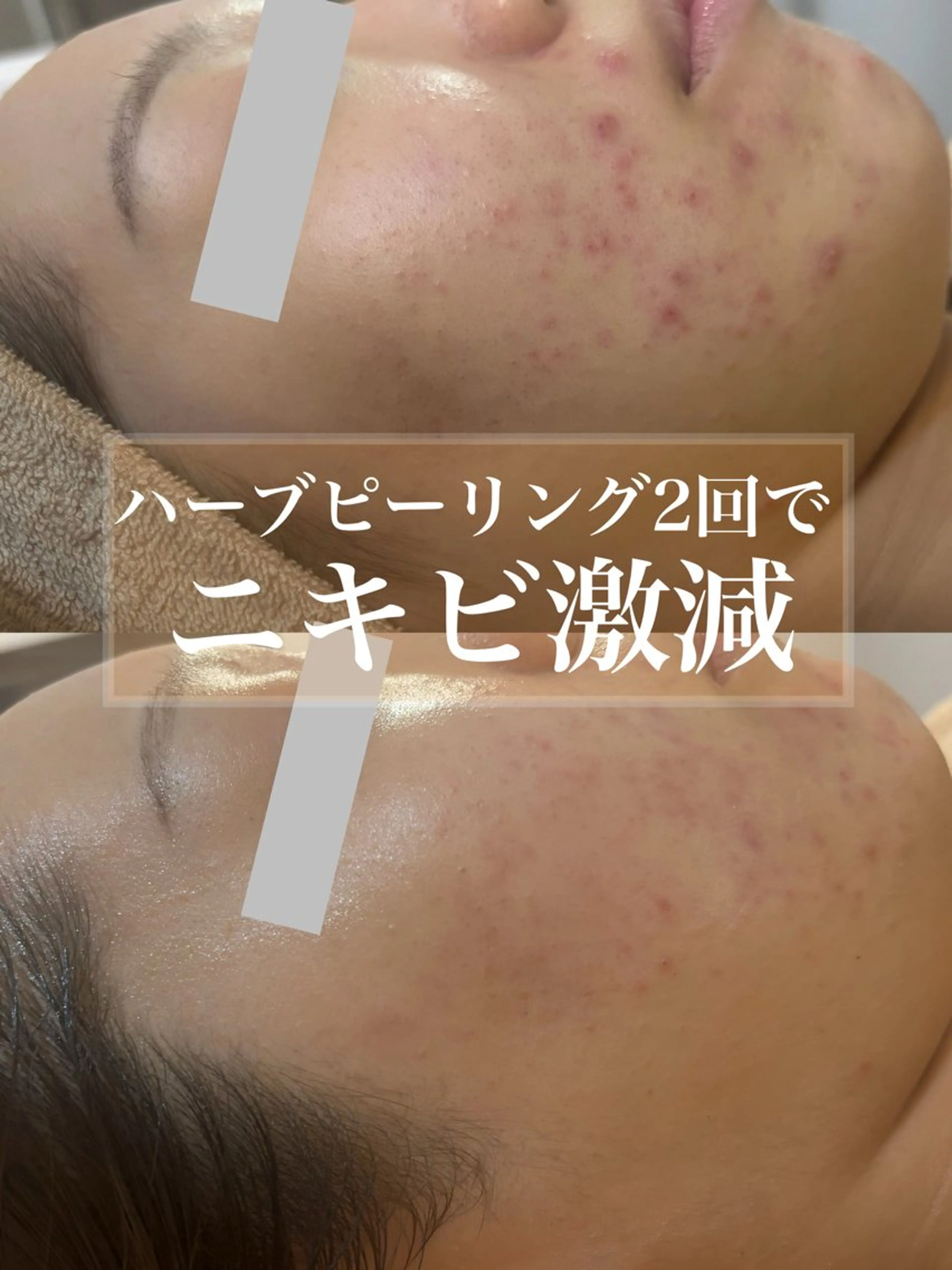 エステ WHITE AQUA 北千住店のエステ・リラクイメージ