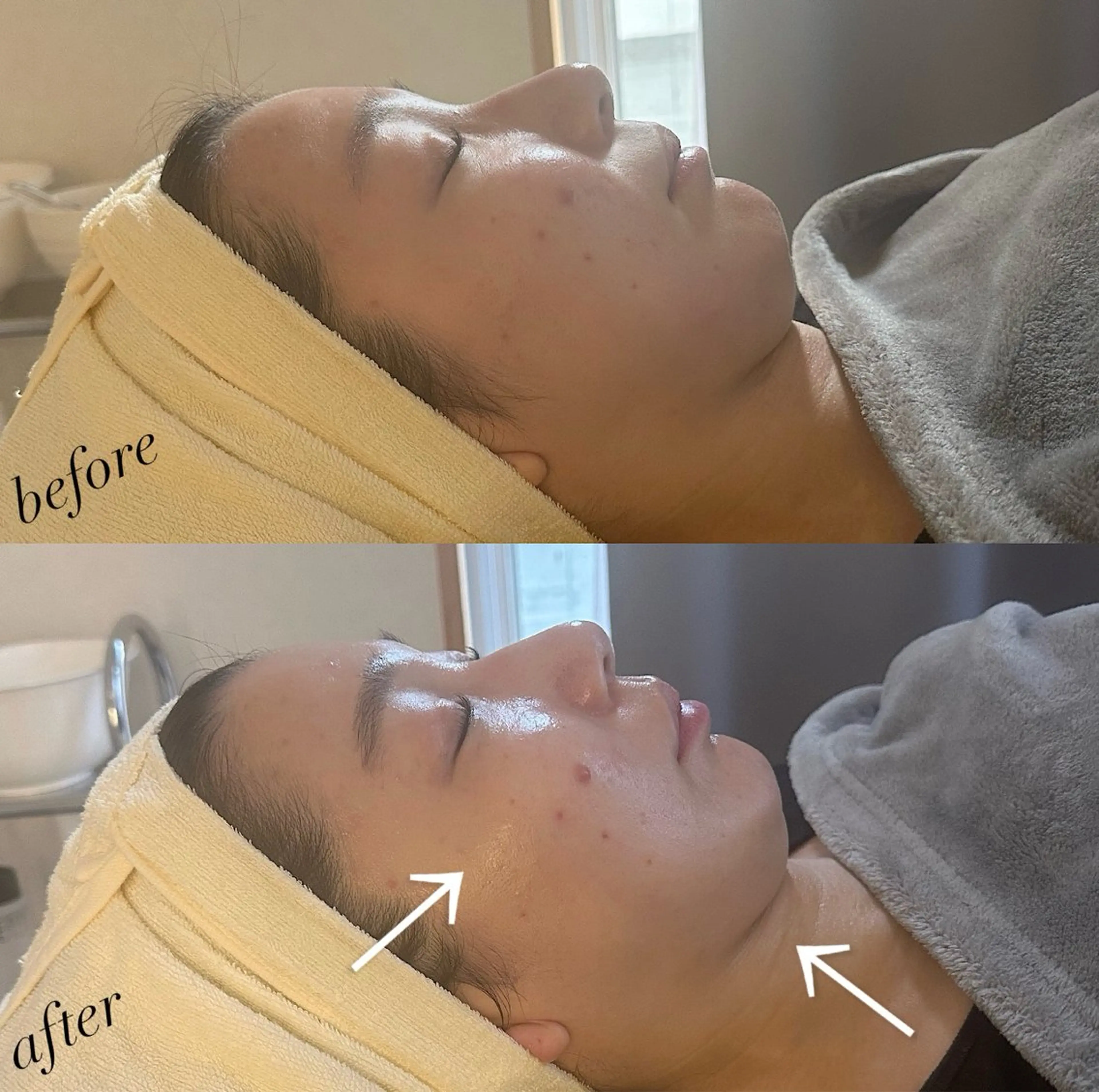 うなじ脱毛/美肌脱毛 LABELのエステ・リラクイメージ