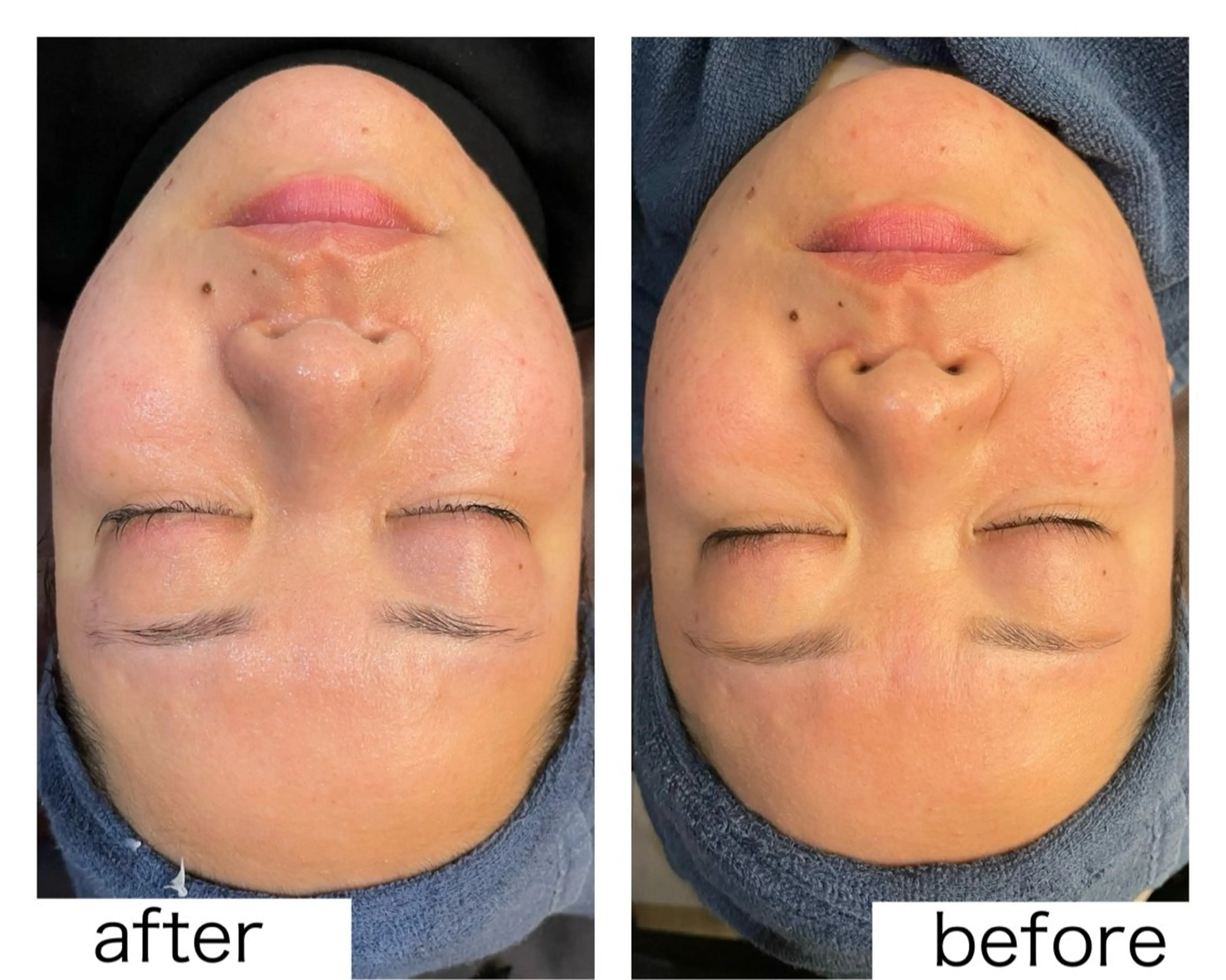 leolo武蔵浦和 肌質改善＆脱毛のエステ・リラクイメージ