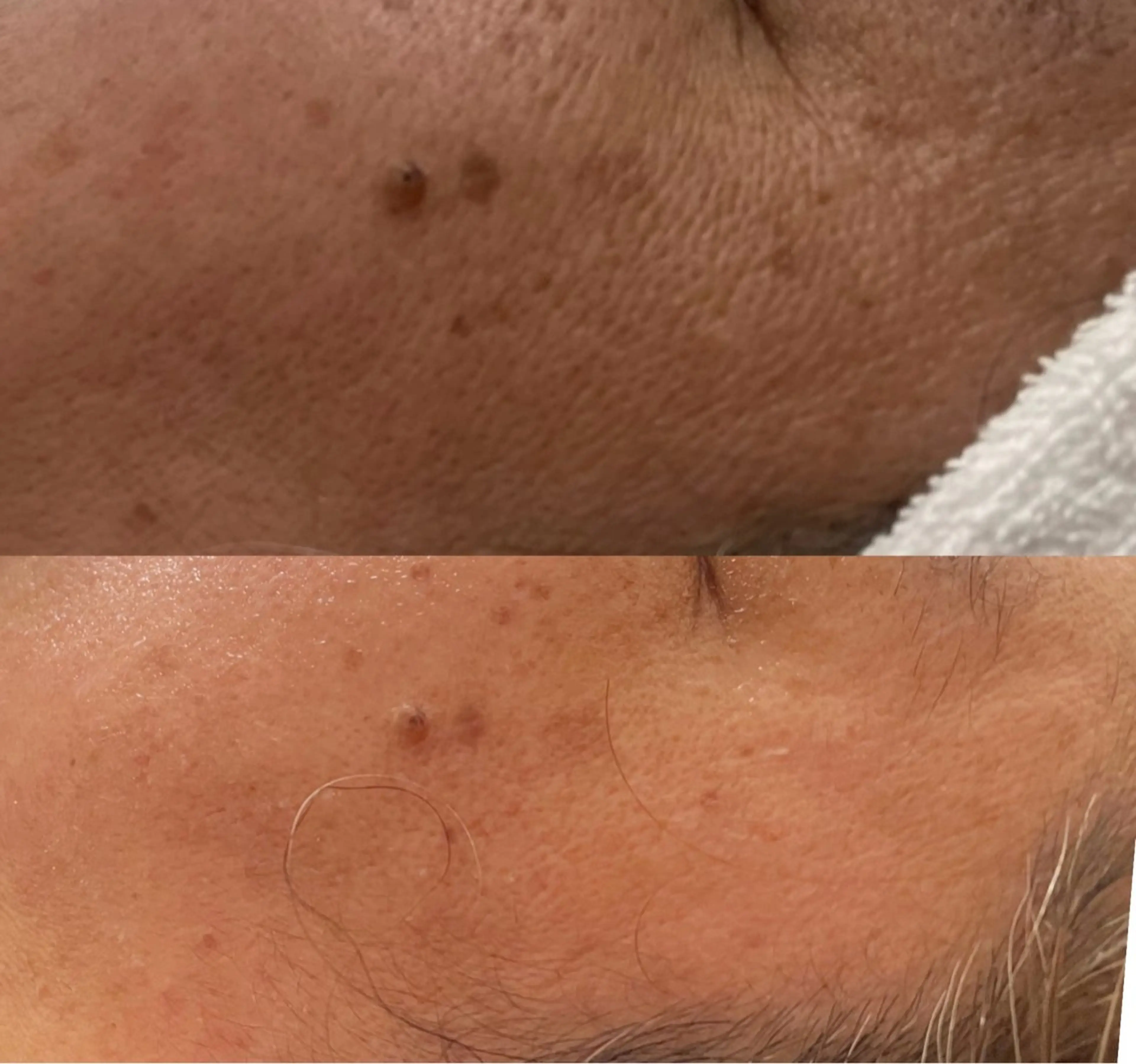 エステ サロン　Ambelle所属・北川 亜友美のエステ・リラクイメージ