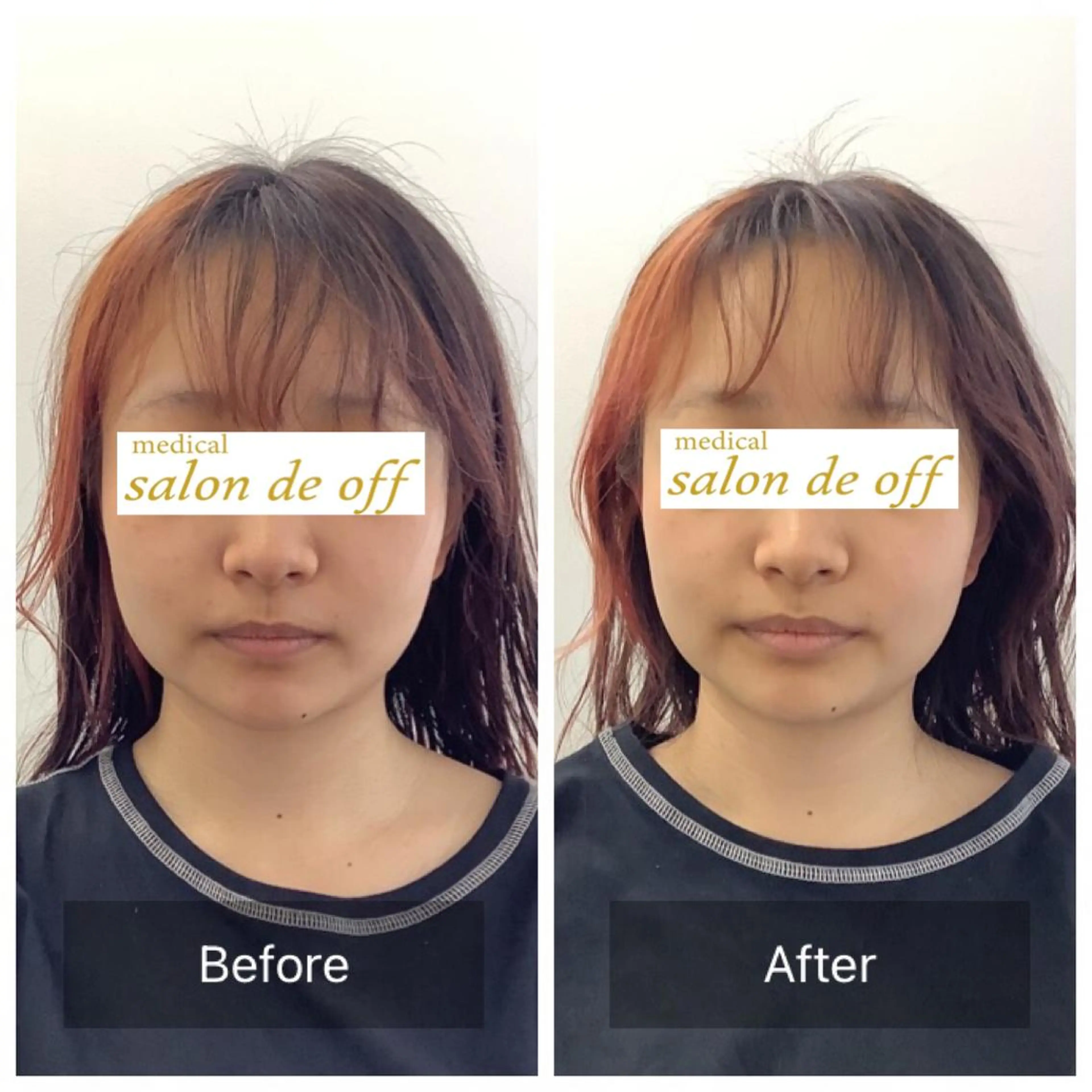 エステ リラク メディカルサロンドオフ所属・ハリサロンドオフ 美容鍼灸×小顔整体のエステ・リラクイメージ