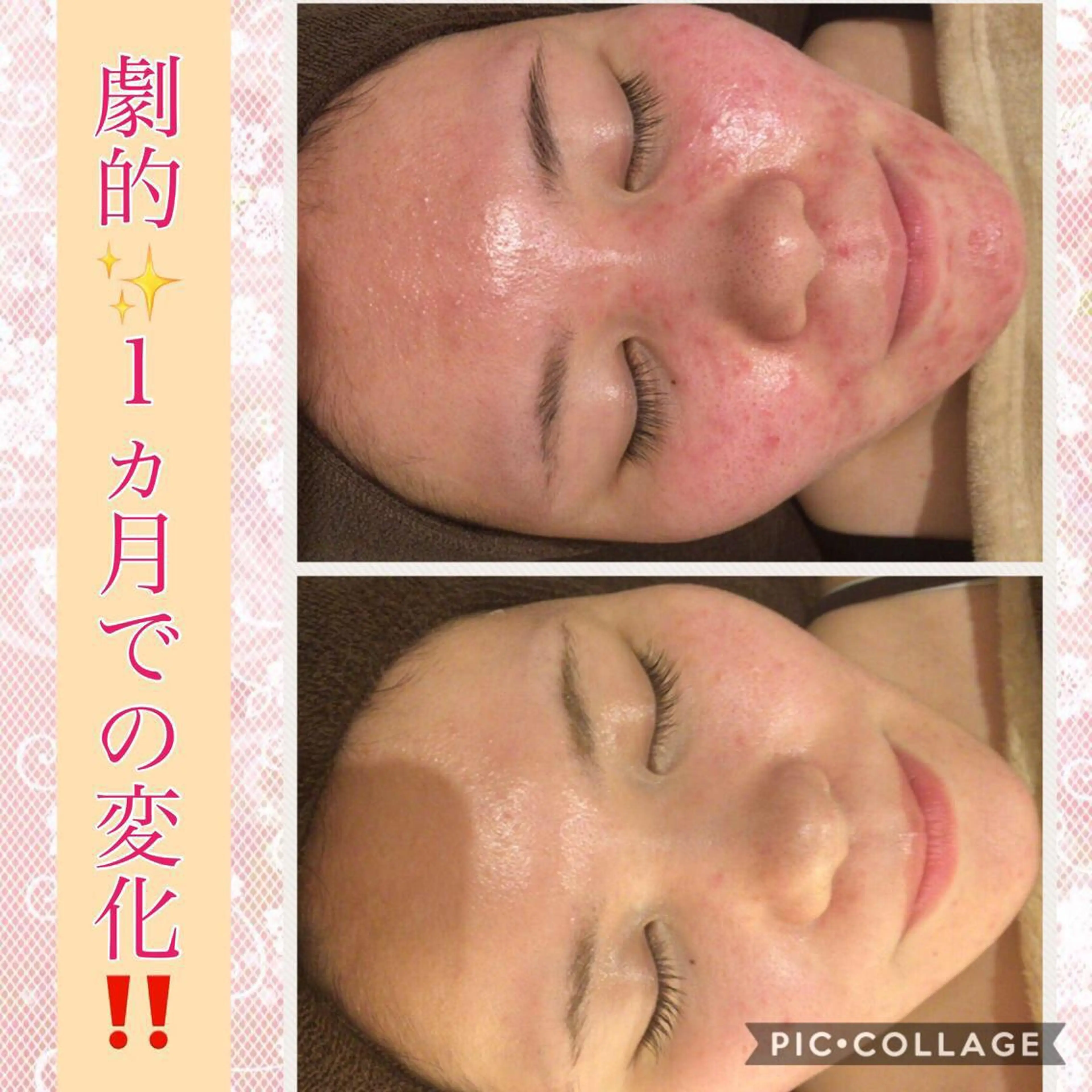 ミディアム カラー パーマ ヘアアレンジ メンズ キッズ ネイル マツエク・マツパ アクール　齋藤 ♡肌トラブル卒業のエステ・リラクイメージ