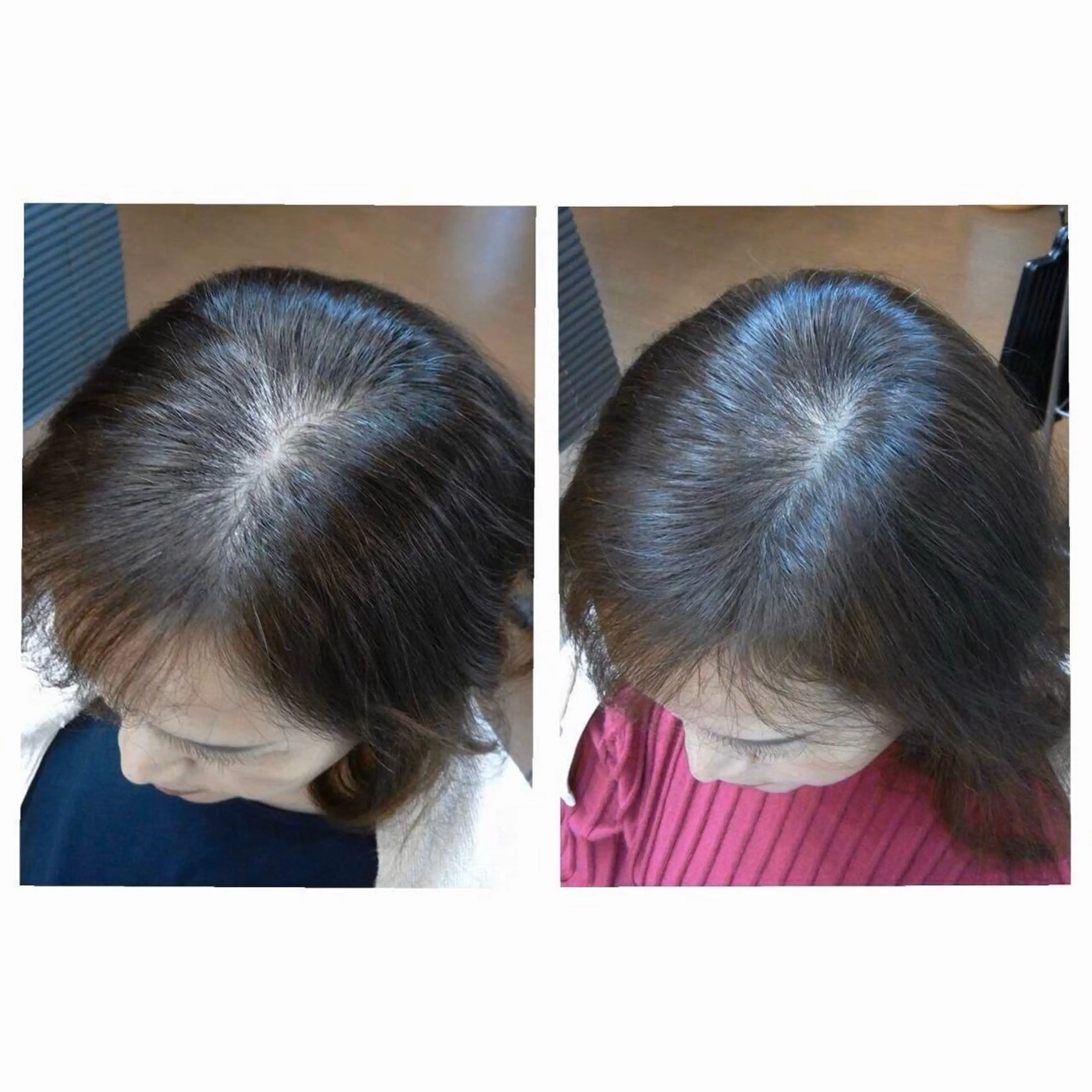 トリートメント ヘッドスパ 痩身・脱毛・美髪ケア 【GLYCINE】のエステ・リラクイメージ
