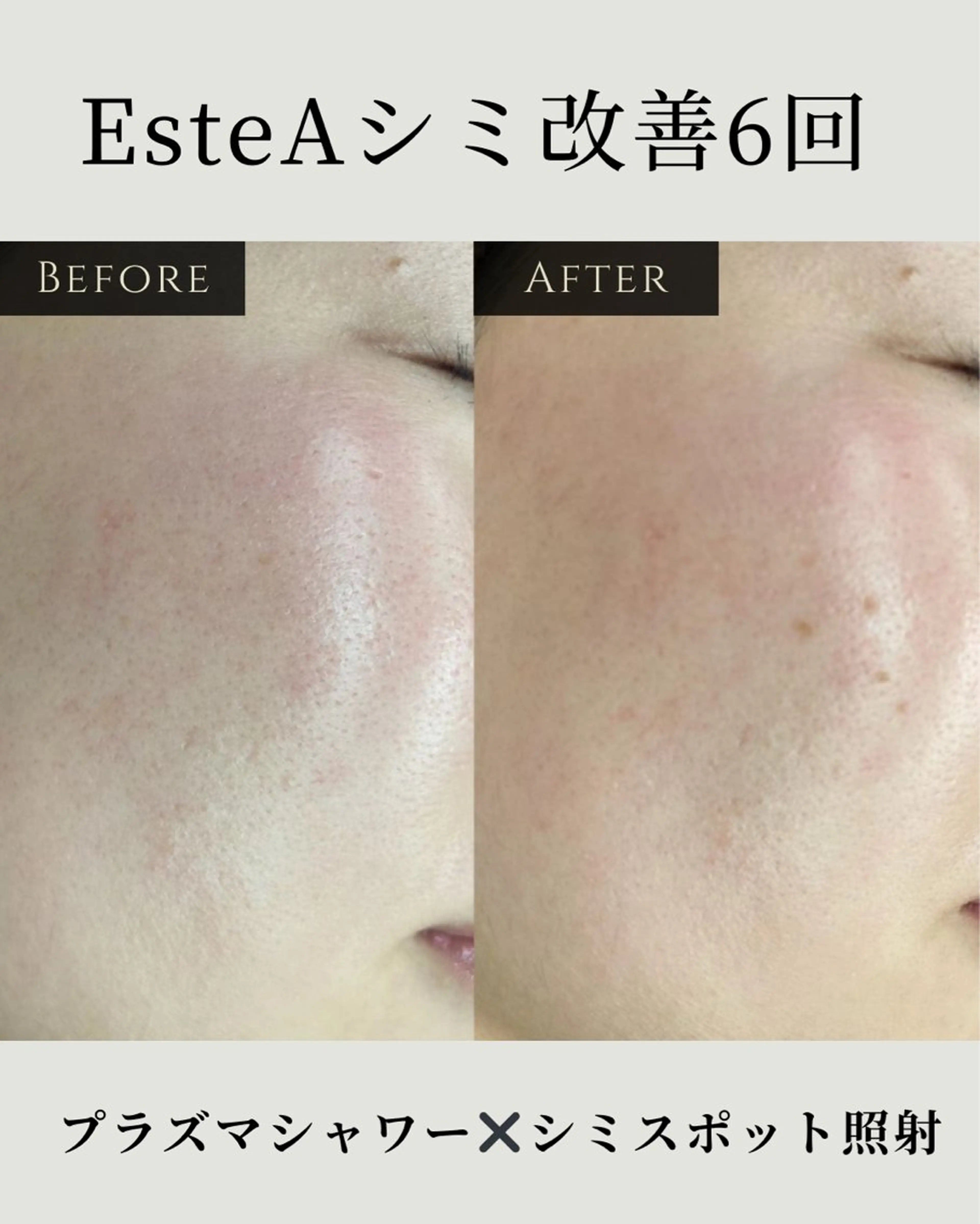 シミ毛穴ケア EsteAのエステ・リラクイメージ