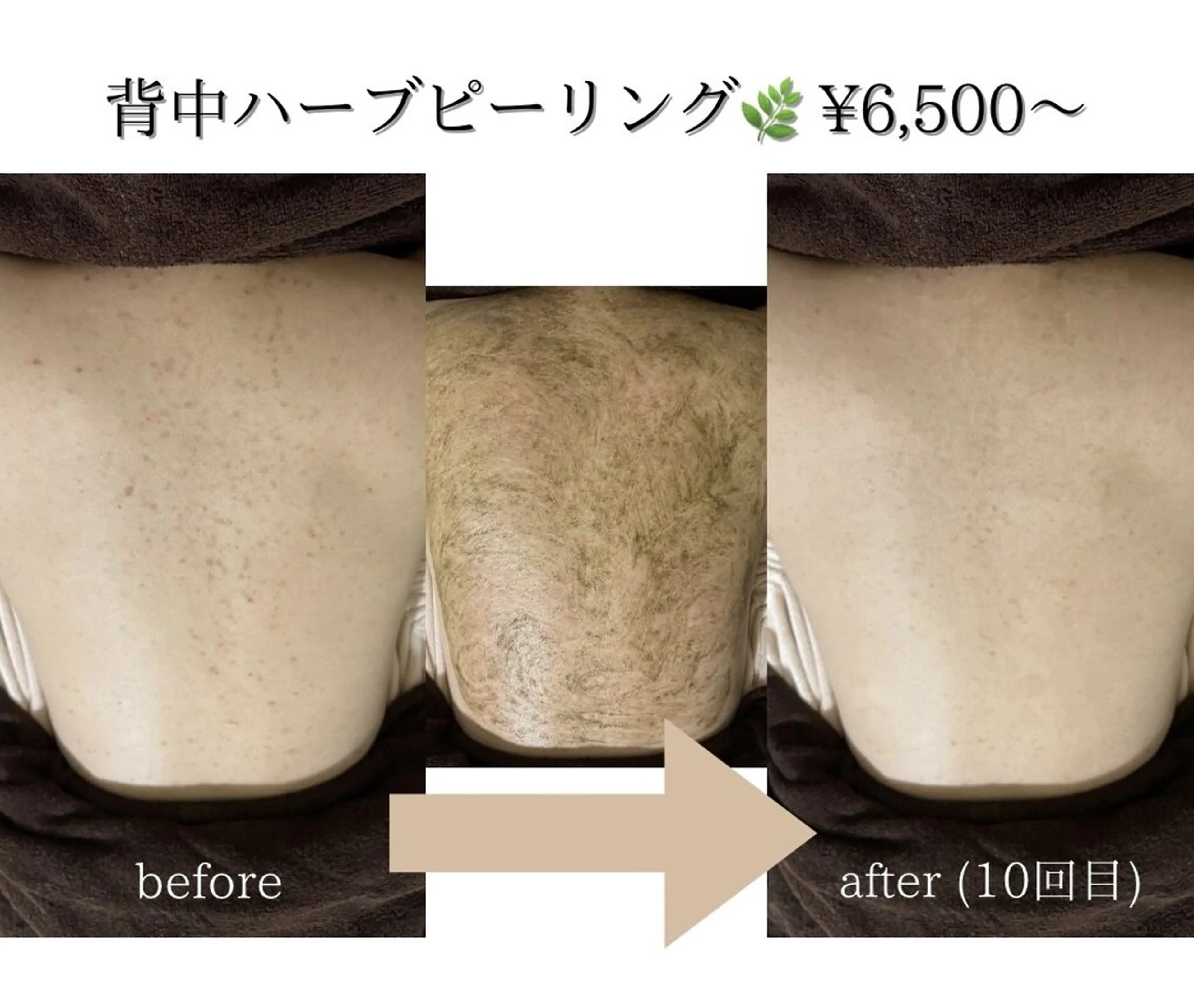 エステ リラク 美肌ケアサロンiru博多祇園店所属・美肌ケアサロンiru 博多祇園店のエステ・リラクイメージ