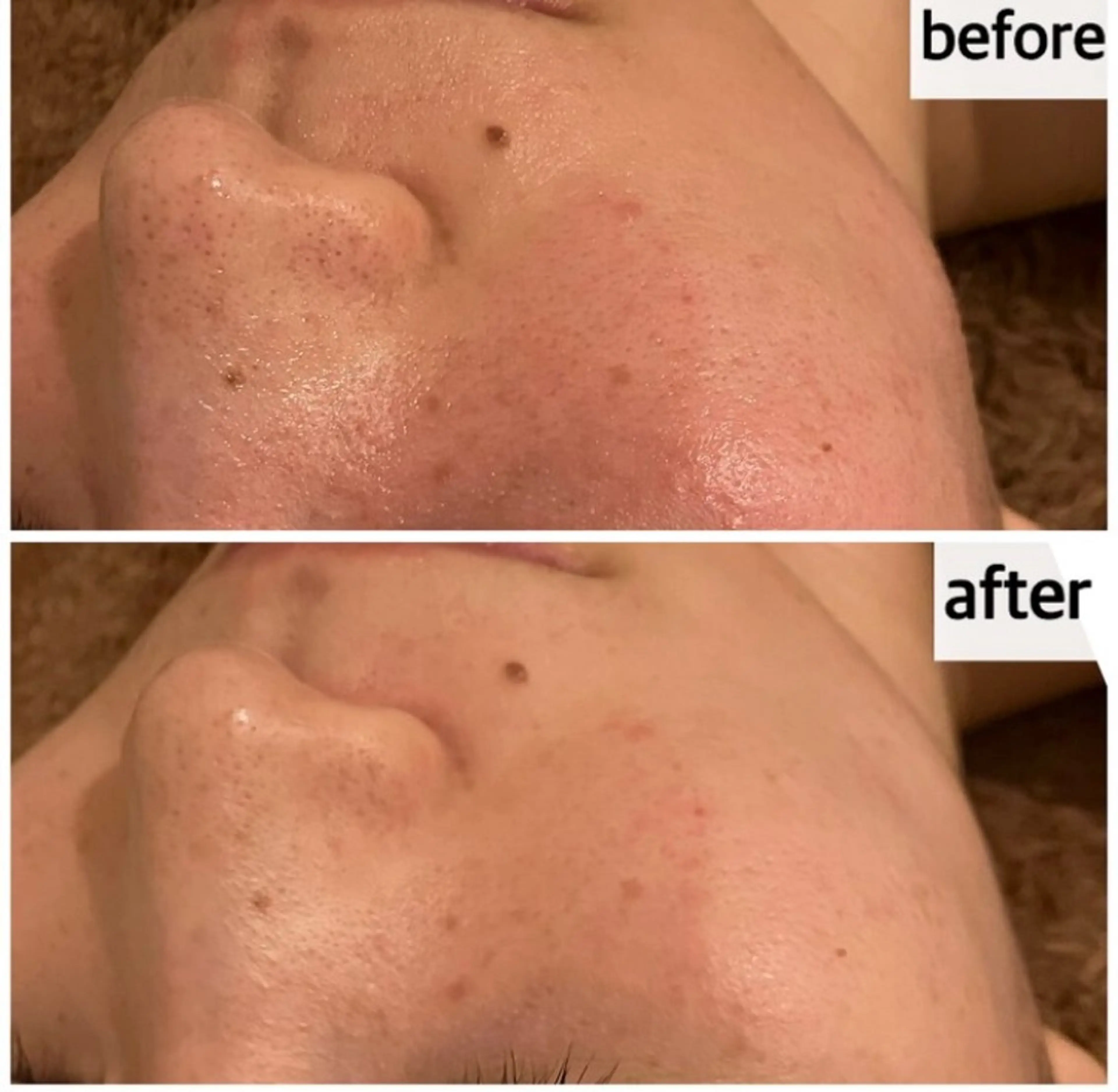 エステ メナード岐阜茜部 杉浦のエステ・リラクイメージ