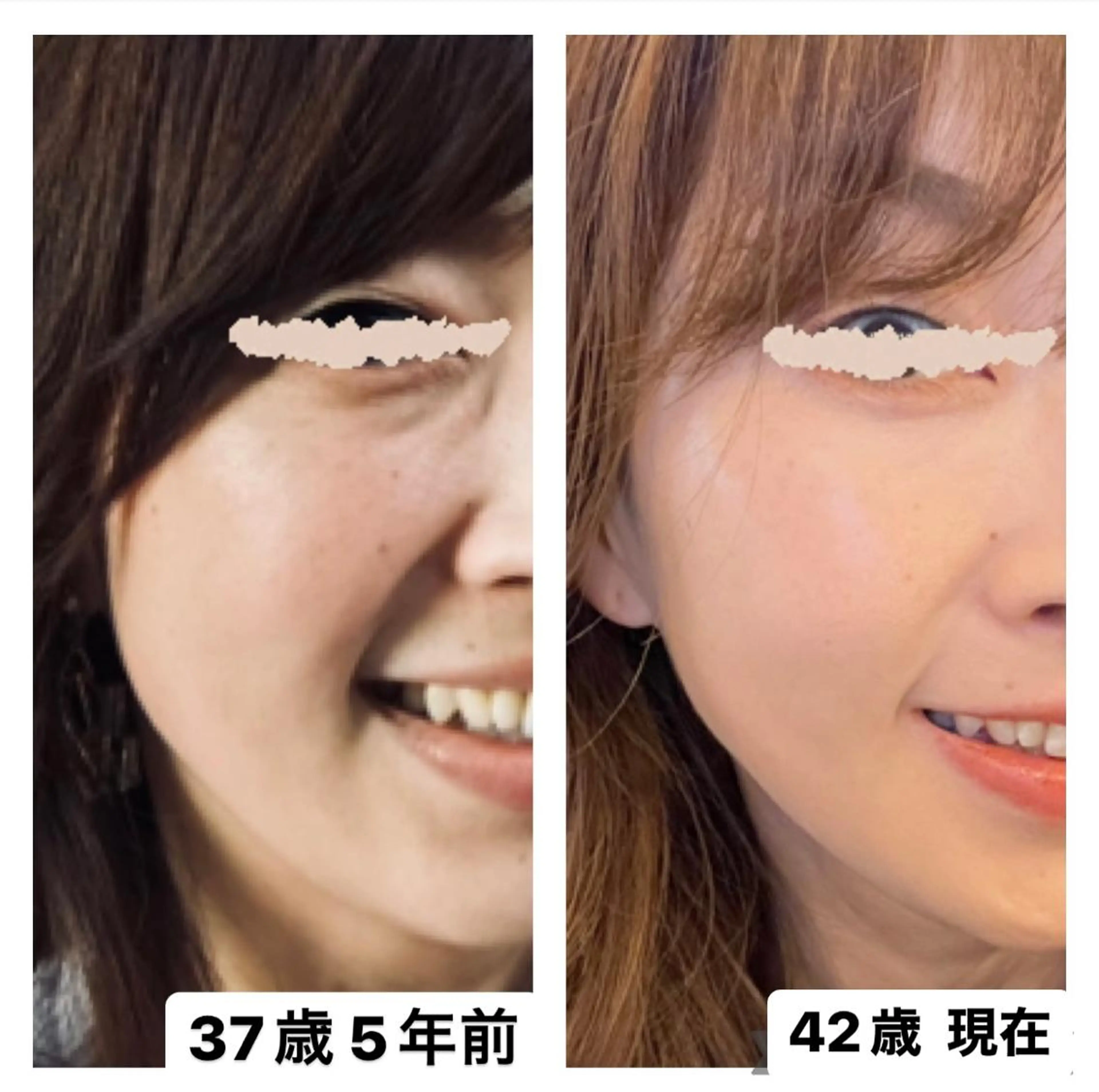 エステ 糸島 エステサロンmiuのエステ・リラクイメージ