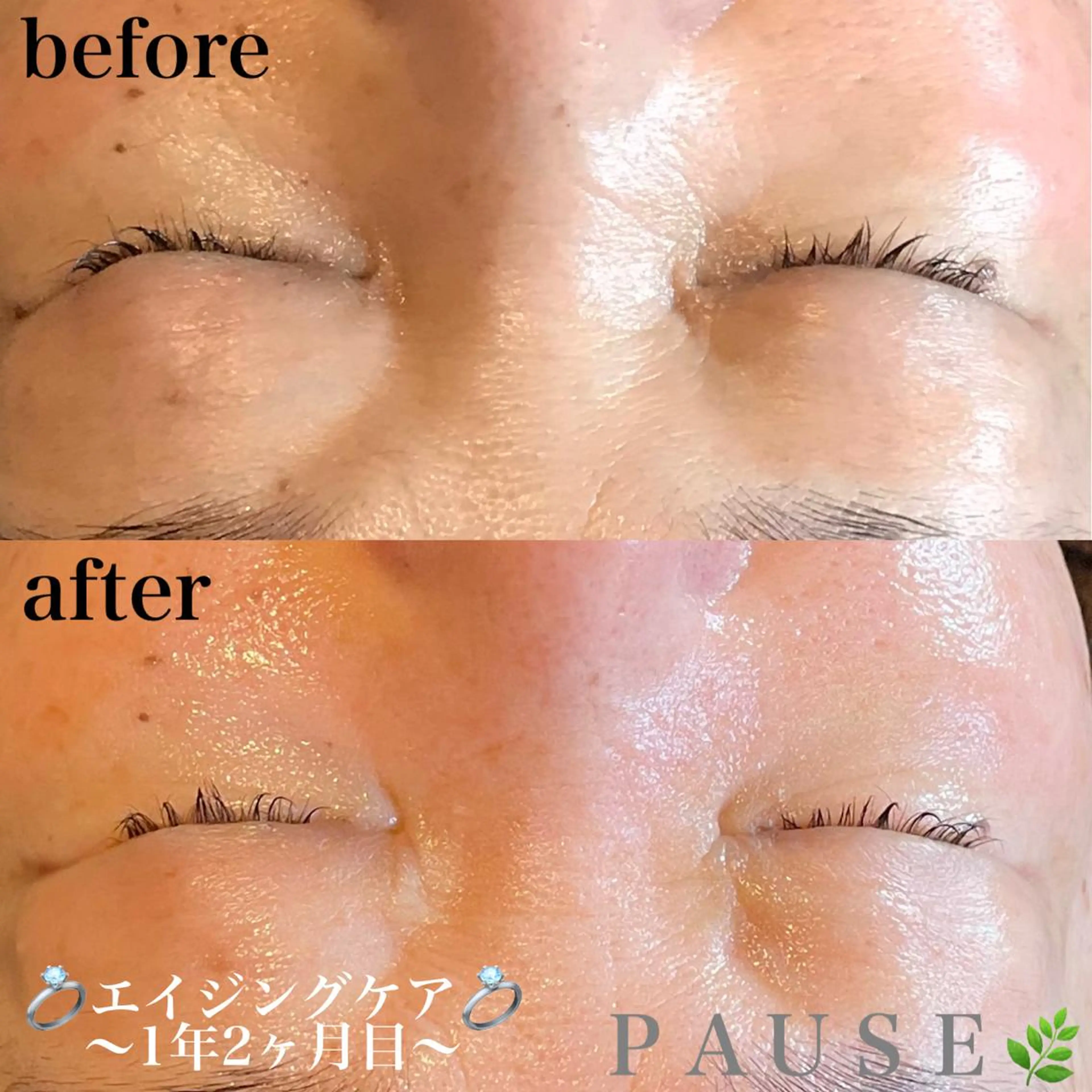 エステ 浜野 恵美のエステ・リラクイメージ